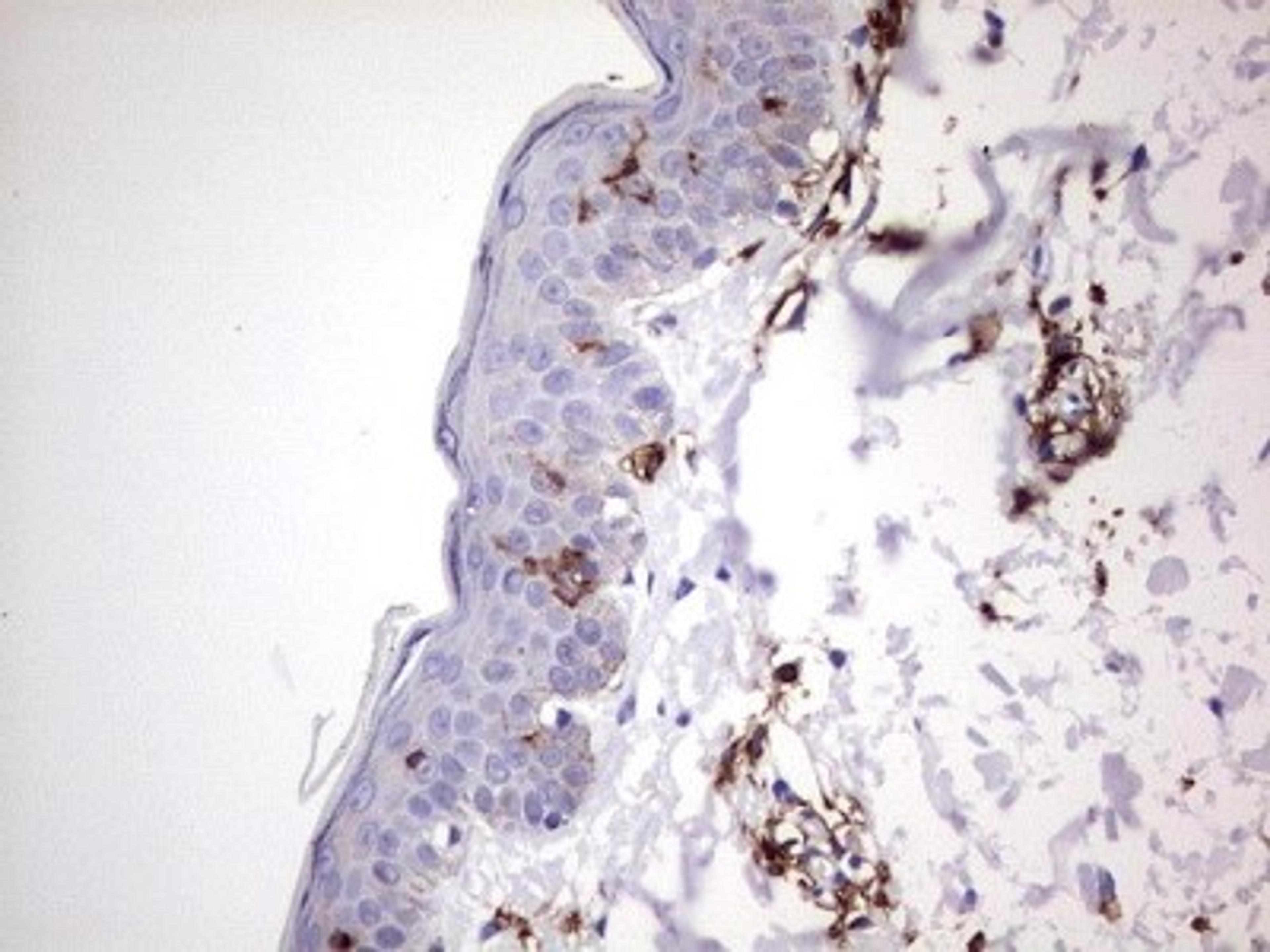 Immunohistochemistry: TACC2 Antibody (3C4) [NBP2-46058] - Analysis of Human skin tissue. (Heat-induced epitope retrieval by 1 mM EDTA in 10mM Tris, pH8.5, 120C for 3min)