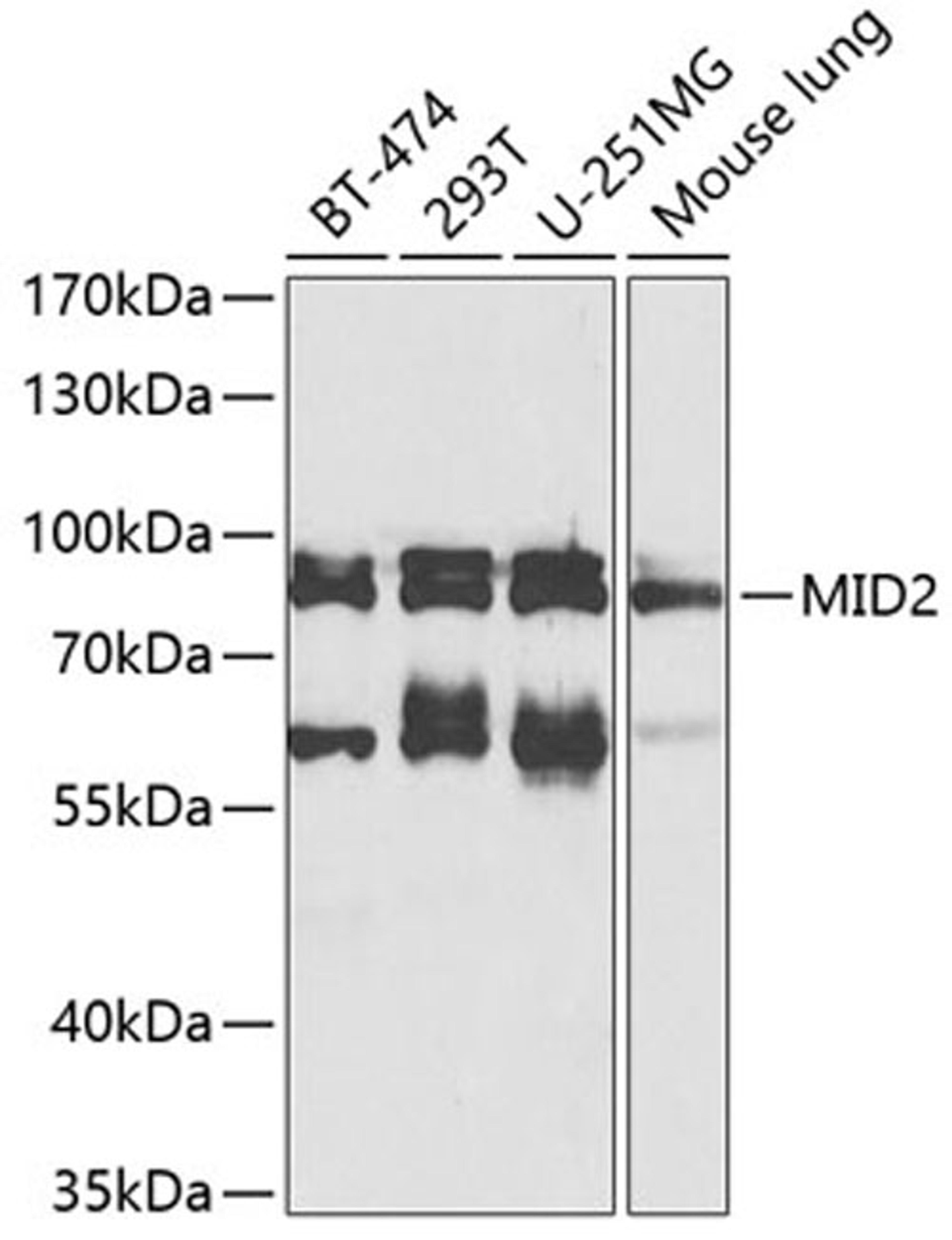 Western blot - MID2 antibody (A8325)