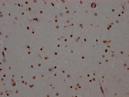 IHC image of CSB-RA906343A0HU diluted at 1:100 and staining in paraffin-embedded human brain tissue performed on a Leica BondTM system. After dewaxing and hydration, antigen retrieval was mediated by high pressure in a citrate buffer (pH 6.0). Section was blocked with 10% normal goat serum 30min at RT. Then primary antibody (1% BSA) was incubated at 4℃ overnight. The primary is detected by a Goat anti-rabbit IgG polymer labeled by HRP and visualized using 0.05% DAB.