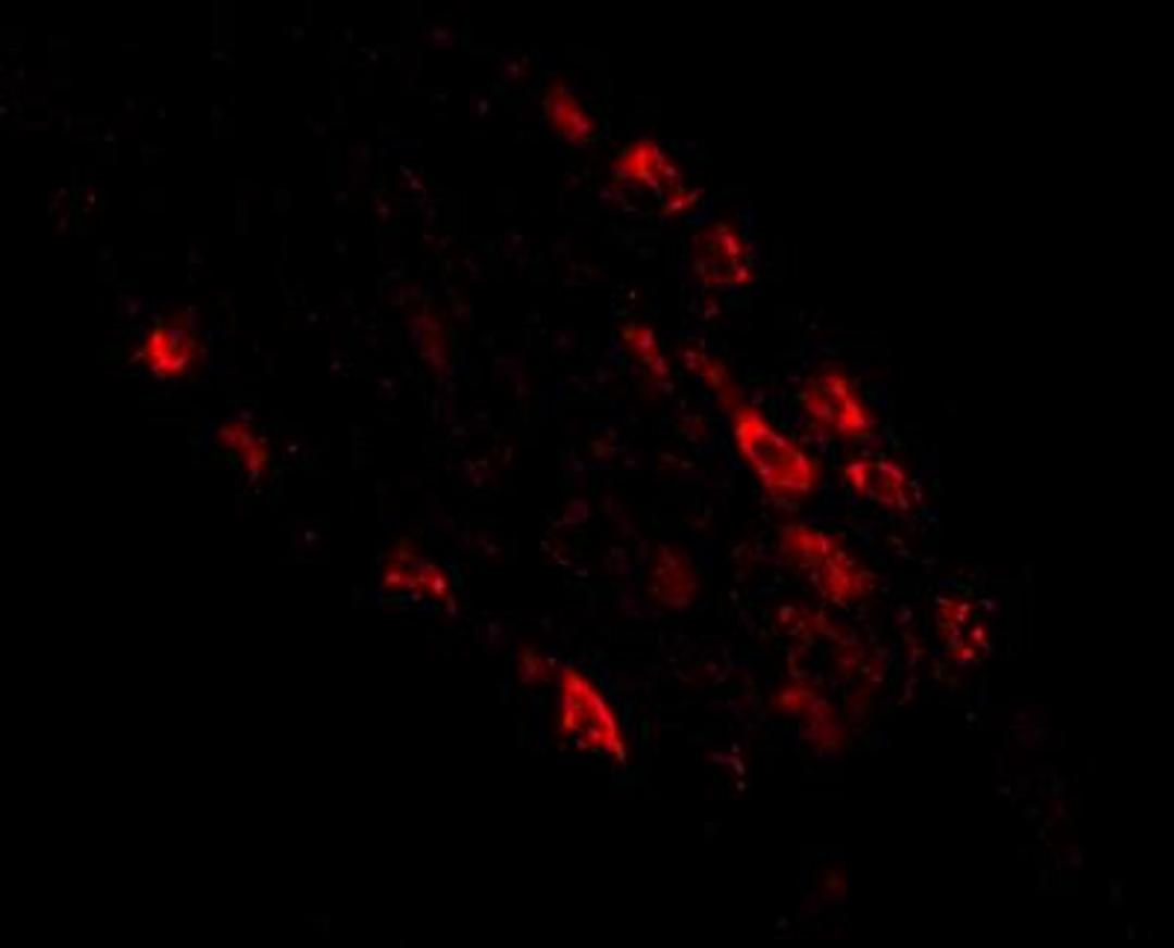 Immunocytochemistry/Immunofluorescence: MEX3D Antibody [NBP1-77332] - Immunofluorescence of rkhd1 in human small intestine tissue with rkhd1 antibody at 20 ug/mL.