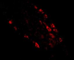 Immunocytochemistry/Immunofluorescence: MEX3D Antibody [NBP1-77332] - Immunofluorescence of rkhd1 in human small intestine tissue with rkhd1 antibody at 20 ug/mL.