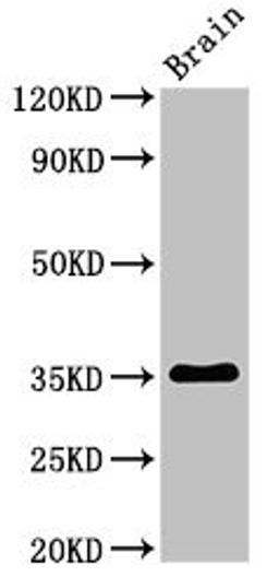 Western Blot. Positive WB detected in: Rat brain tissue. All lanes: Metrnl antibody at 3ug/ml. Secondary. Goat polyclonal to rabbit IgG at 1/50000 dilution. Predicted band size: 35, 36 kDa. Observed band size: 35 kDa. 