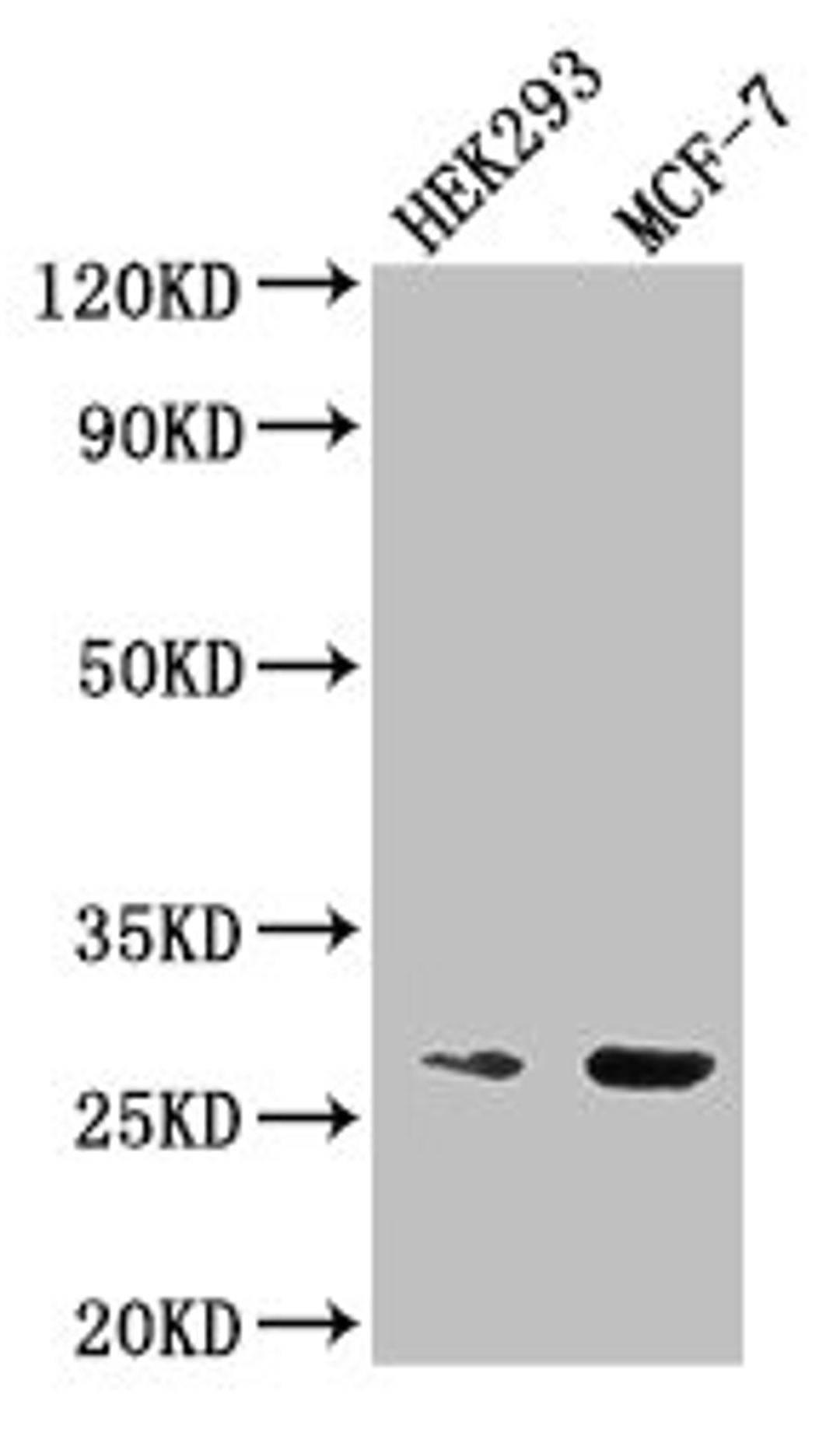 Western Blot. Positive WB detected in: HEK293 whole cell lysate, MCF-7 whole cell lysate. All lanes: NUDT21 antibody at 2.5µg/ml. Secondary. Goat polyclonal to rabbit IgG at 1/50000 dilution. Predicted band size: 27 kDa. Observed band size: 27 kDa