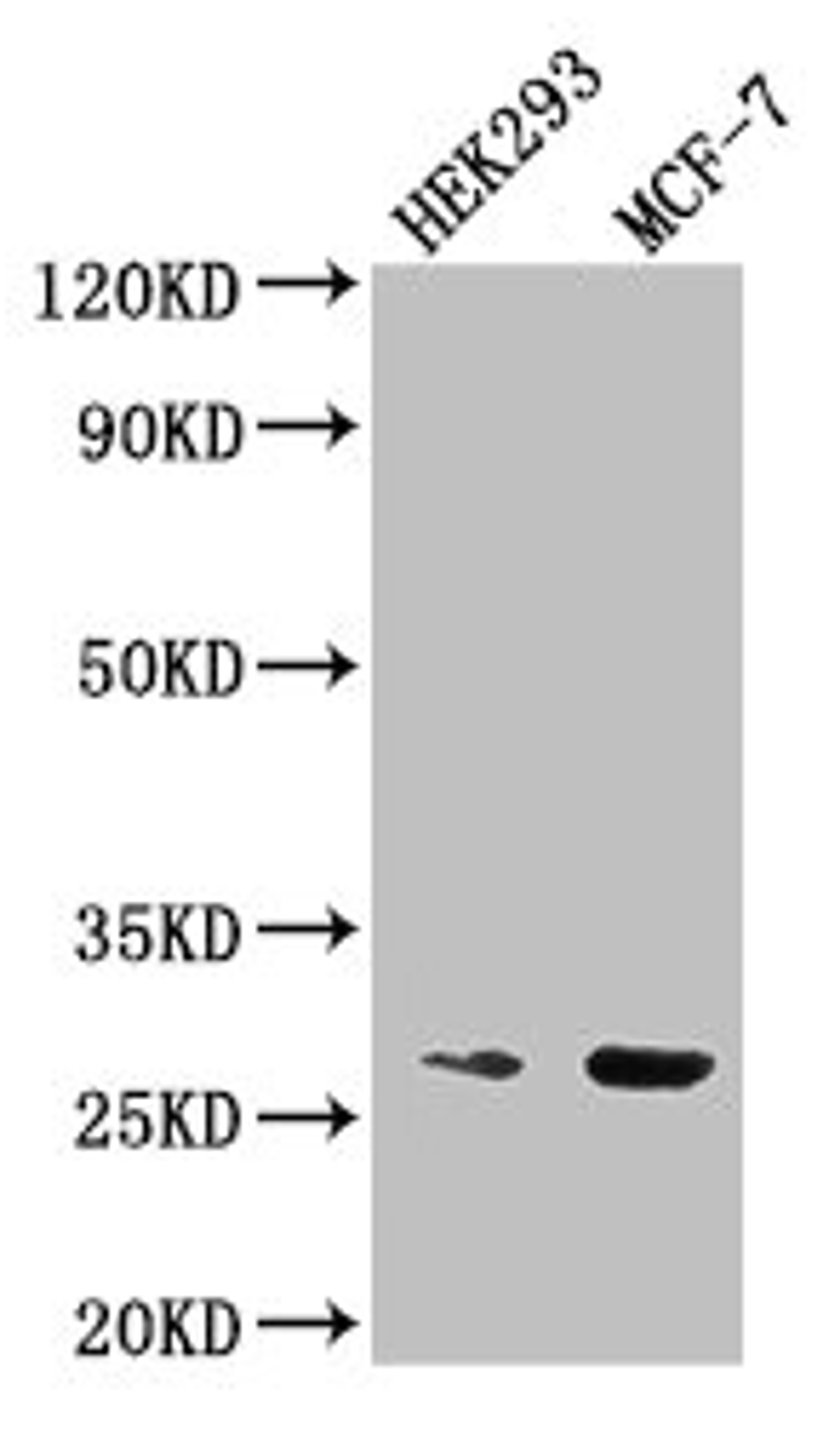 Western Blot. Positive WB detected in: HEK293 whole cell lysate, MCF-7 whole cell lysate. All lanes: NUDT21 antibody at 2.5µg/ml. Secondary. Goat polyclonal to rabbit IgG at 1/50000 dilution. Predicted band size: 27 kDa. Observed band size: 27 kDa