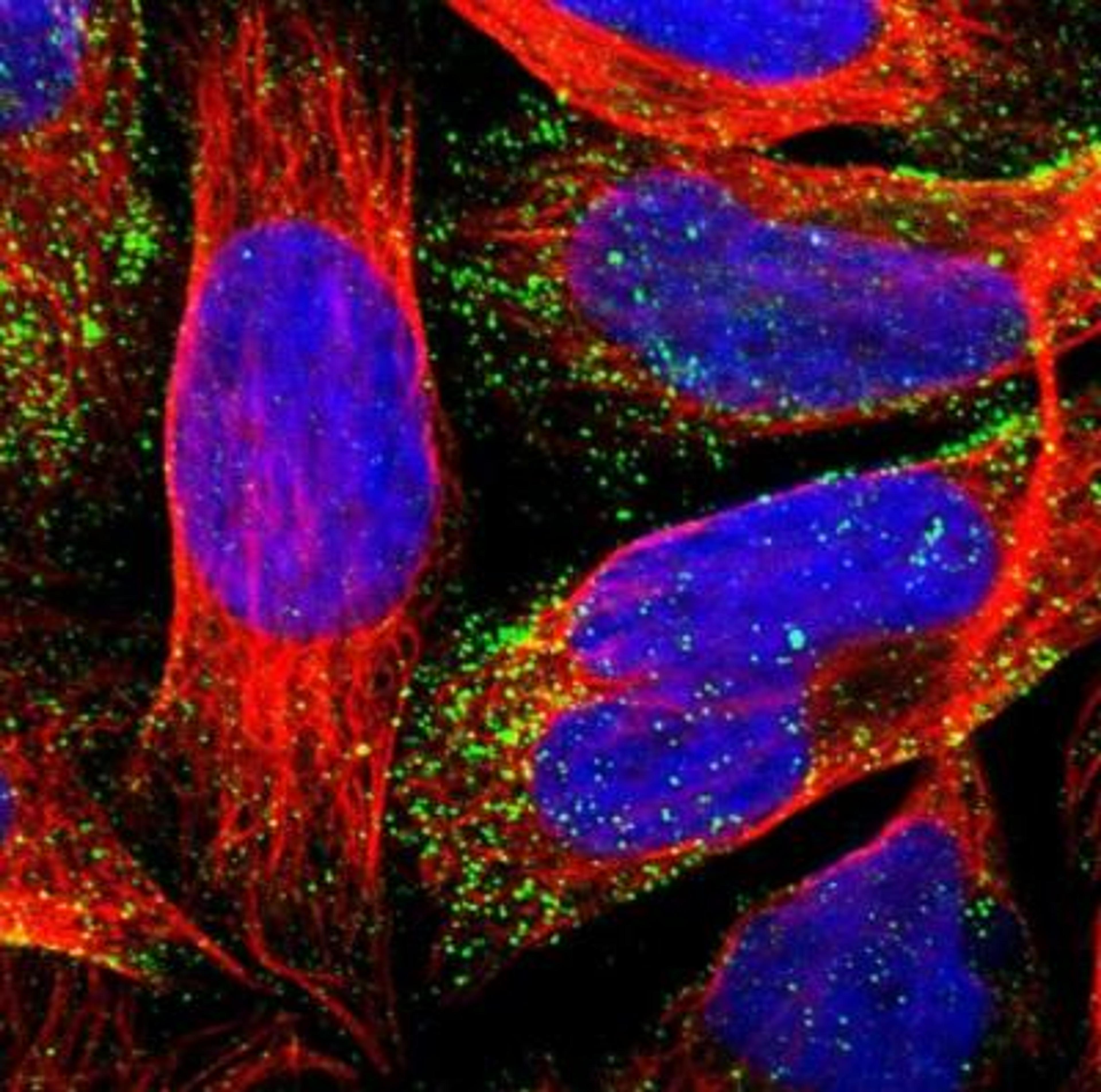 Immunocytochemistry/Immunofluorescence: SLC22A15 Antibody [NBP1-84662] - Staining of human cell line U-2 OS shows positivity in vesicles. Antibody staining is shown in green.