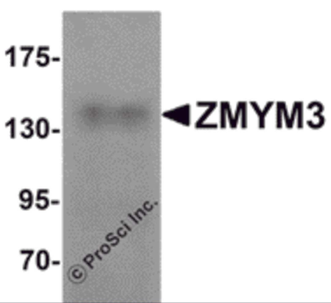 Western blot analysis of ZMYM3 in human brain tissue lysate with ZMYM3 antibody at 1 μg/mL.