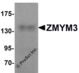Western blot analysis of ZMYM3 in human brain tissue lysate with ZMYM3 antibody at 1 μg/mL.