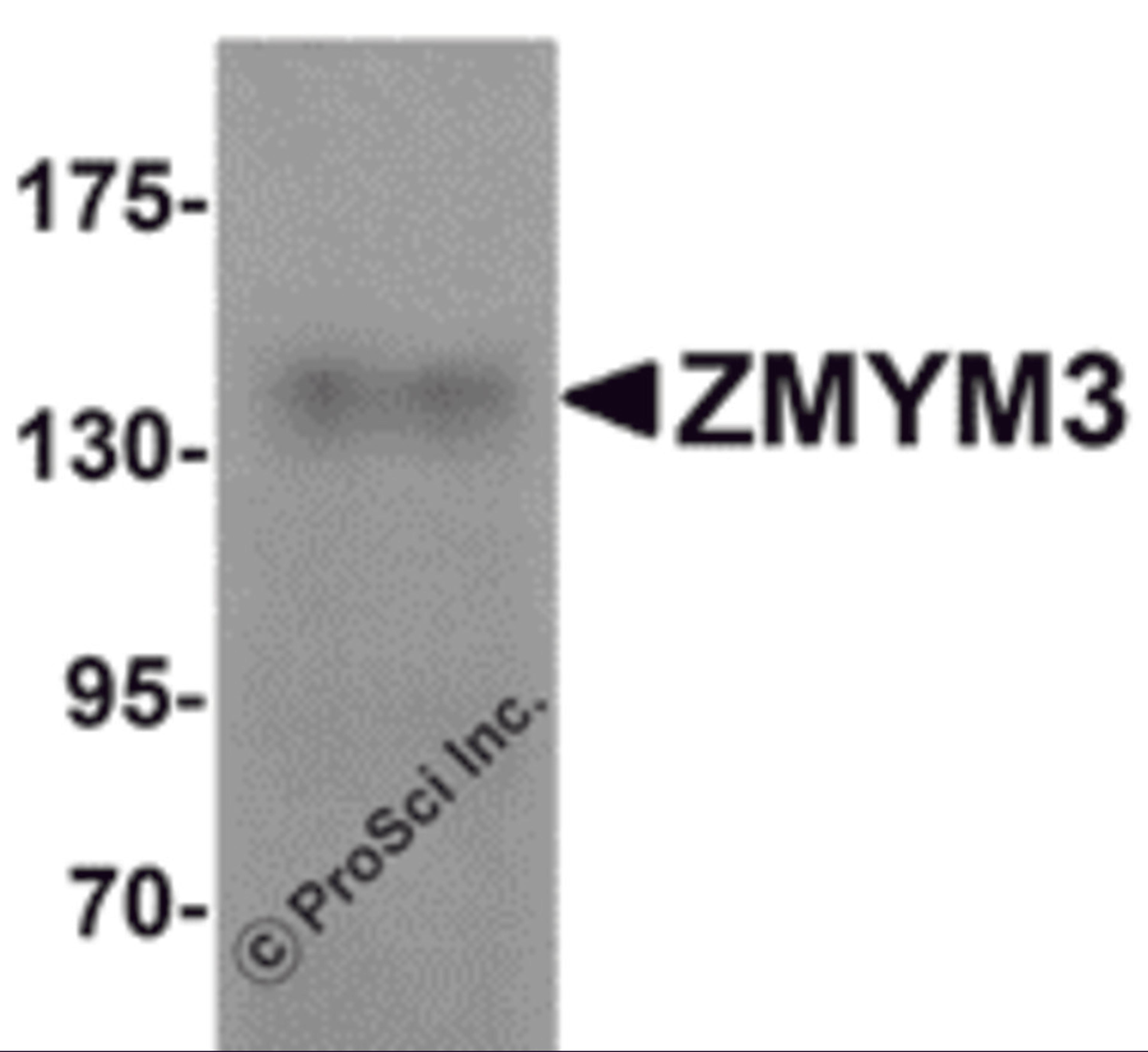 Western blot analysis of ZMYM3 in human brain tissue lysate with ZMYM3 antibody at 1 μg/mL.