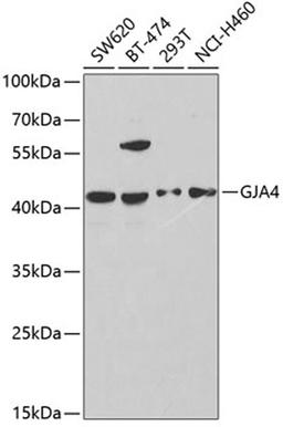 Western blot - GJA4 antibody (A2529)