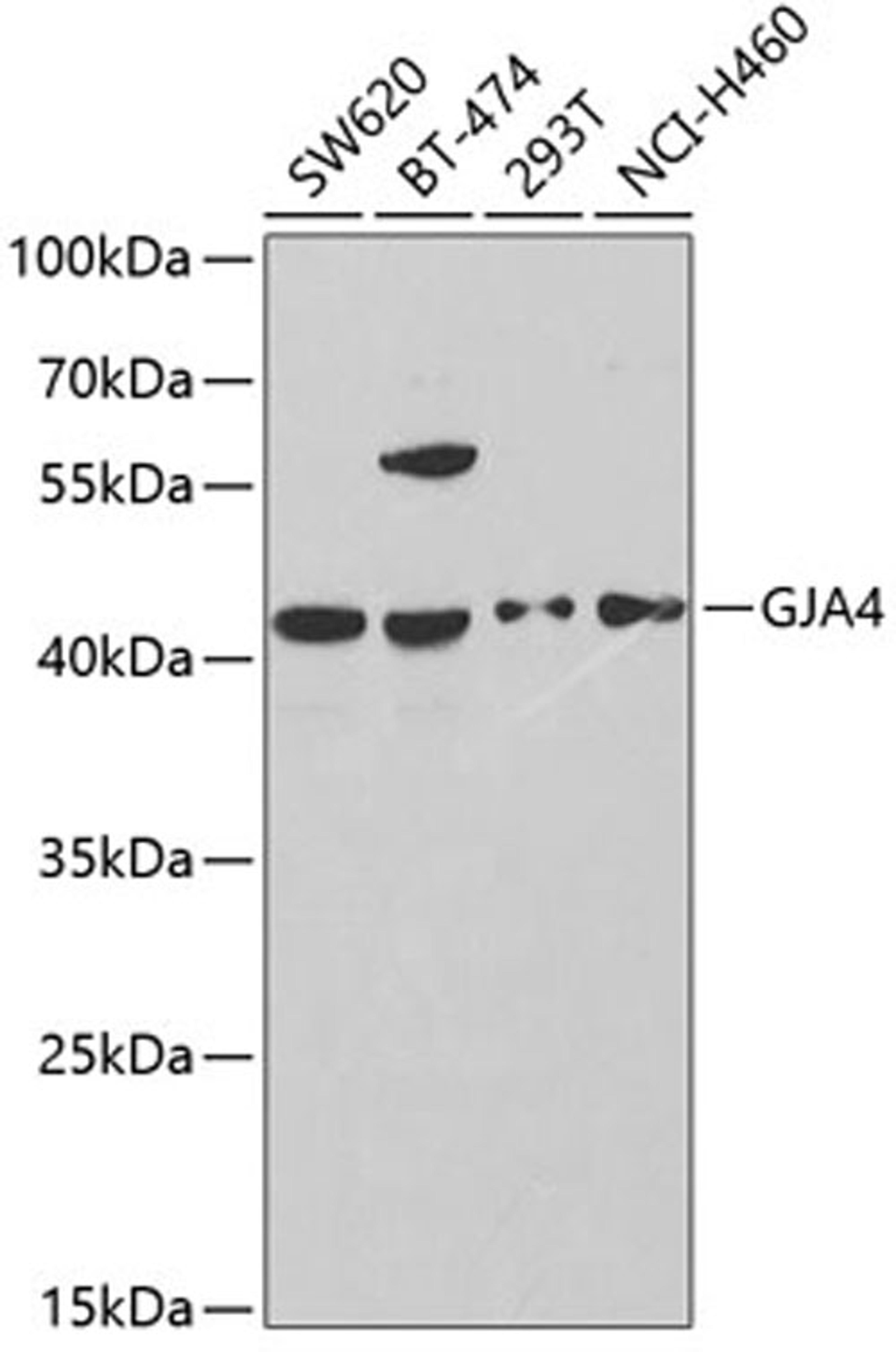 Western blot - GJA4 antibody (A2529)