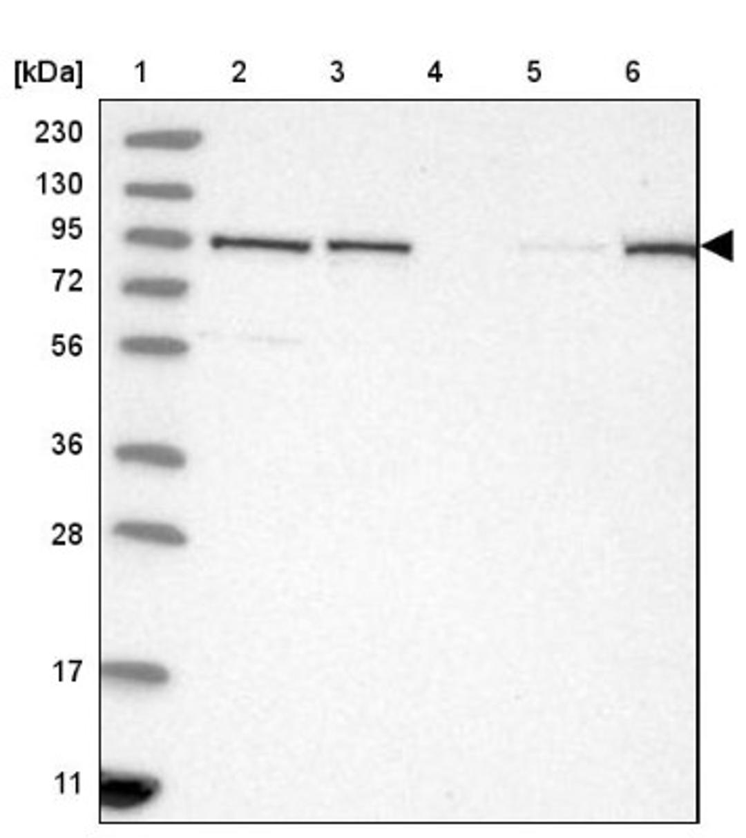 Western Blot: TBC1D5 Antibody [NBP2-38237] - Lane 1: Marker [kDa] 230, 130, 95, 72, 56, 36, 28, 17, 11<br/>Lane 2: RT-4<br/>Lane 3: U-251 MG<br/>Lane 4: Human Plasma<br/>Lane 5: Liver<br/>Lane 6: Tonsil