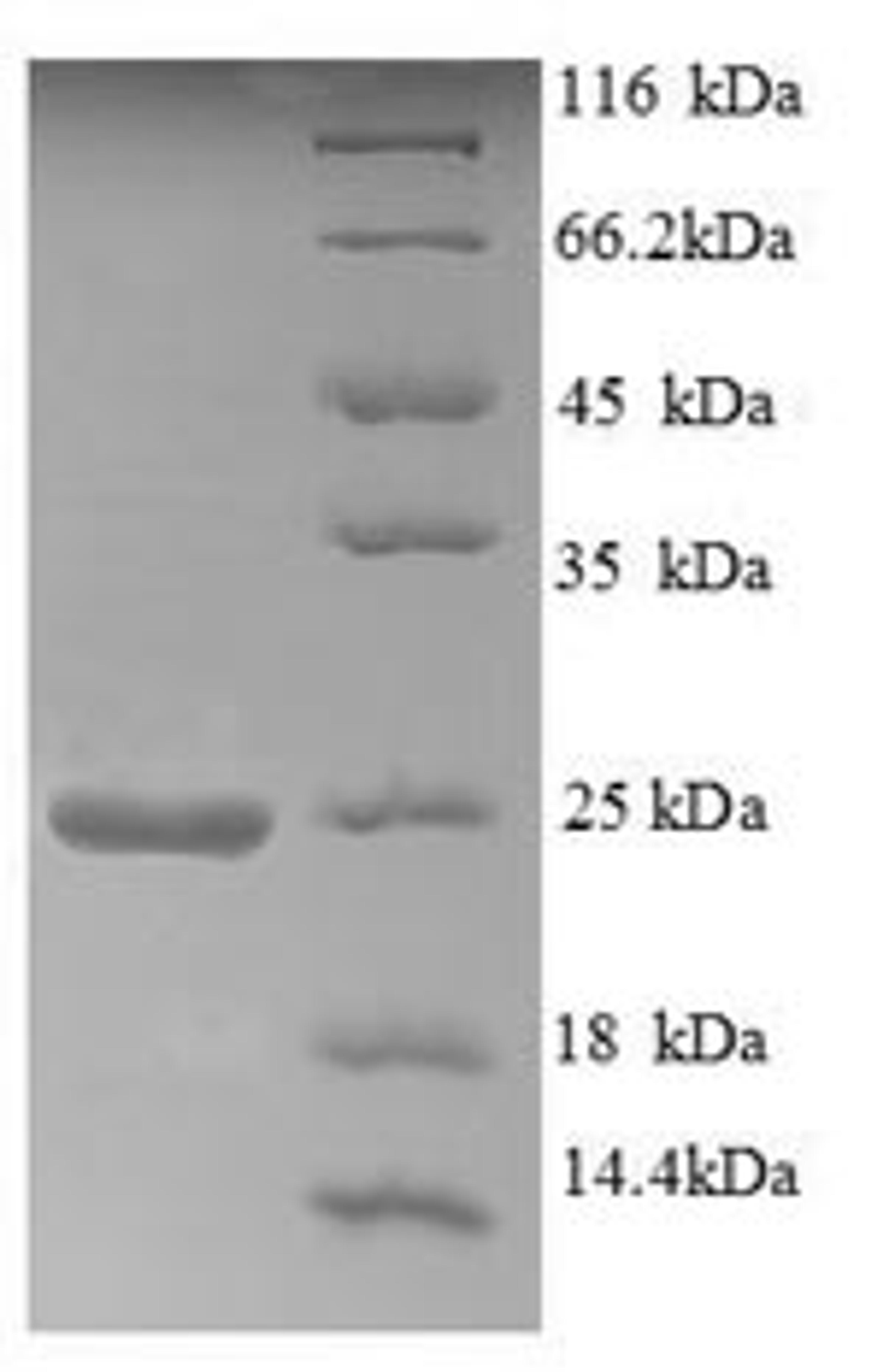 (Tris-Glycine gel) Discontinuous SDS-PAGE (reduced) with 5% enrichment gel and 15% separation gel.