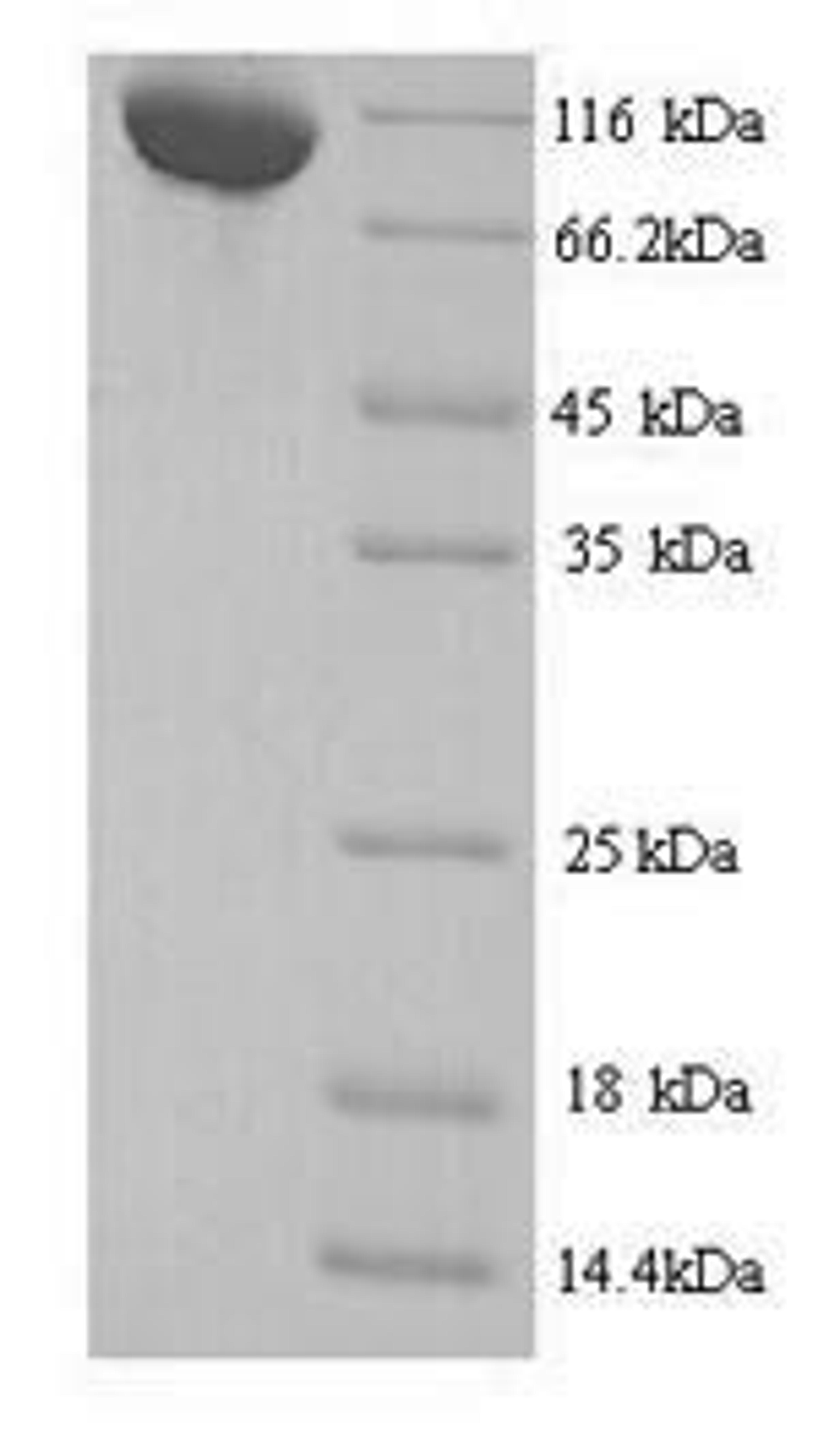 (Tris-Glycine gel) Discontinuous SDS-PAGE (reduced) with 5% enrichment gel and 15% separation gel.
