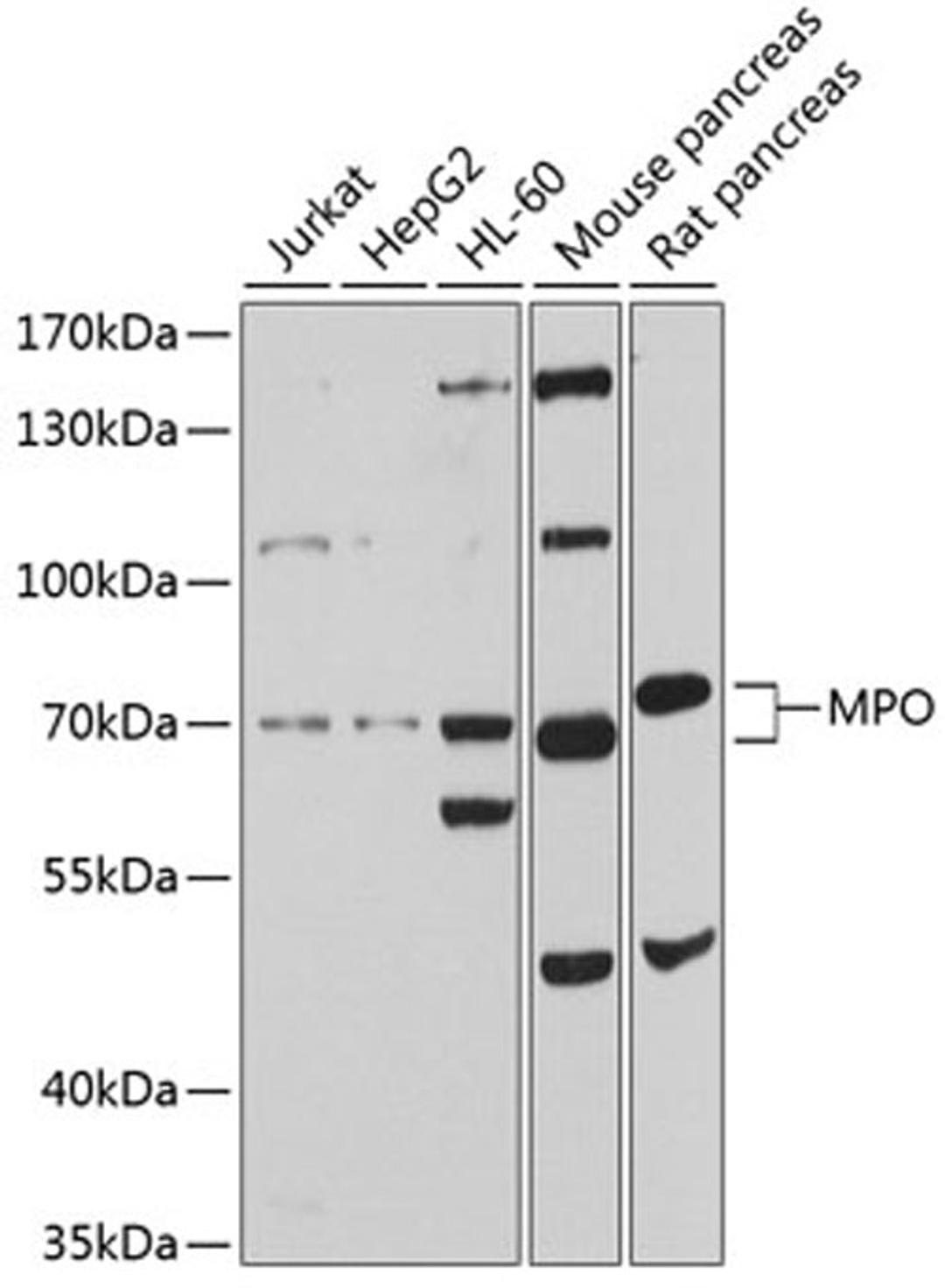 Western blot - MPO antibody (A1374)