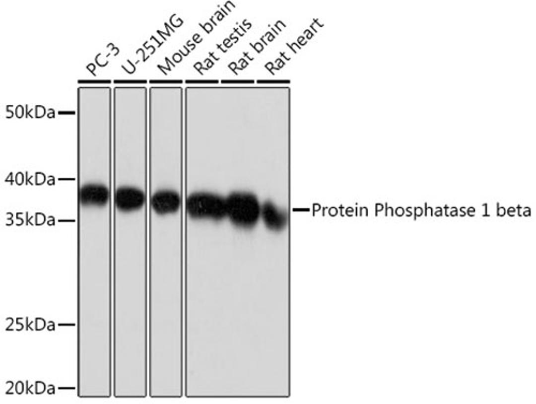 Western blot - Protein Phosphatase 1 beta Rabbit mAb (A4364)