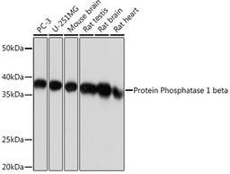 Western blot - Protein Phosphatase 1 beta Rabbit mAb (A4364)