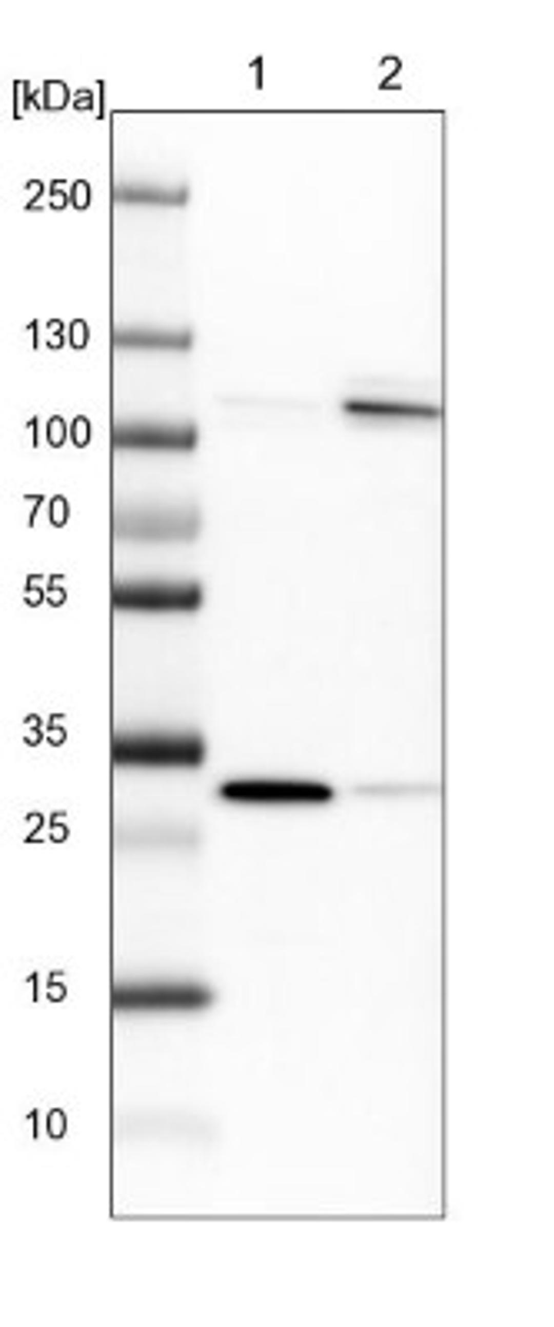 Western Blot: SREC-II/SCARF2 Antibody [NBP1-83140] - Lane 1: NIH-3T3 cell lysate (Mouse embryonic fibroblast cells)<br/>Lane 2: NBT-II cell lysate (Rat Wistar bladder tumour cells)