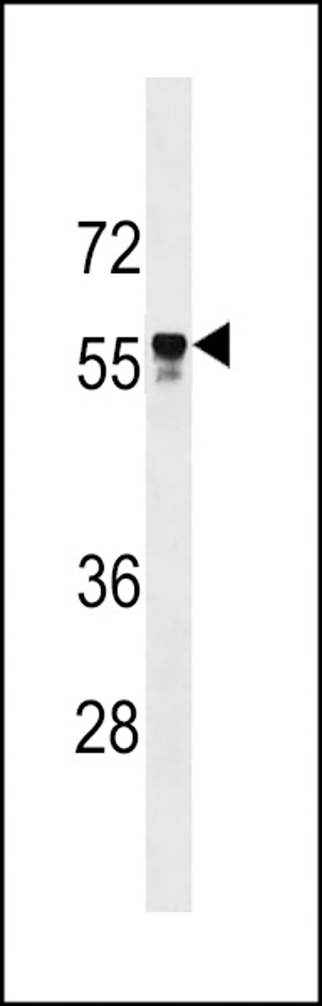 Western blot analysis in CEM cell line lysates (35ug/lane).