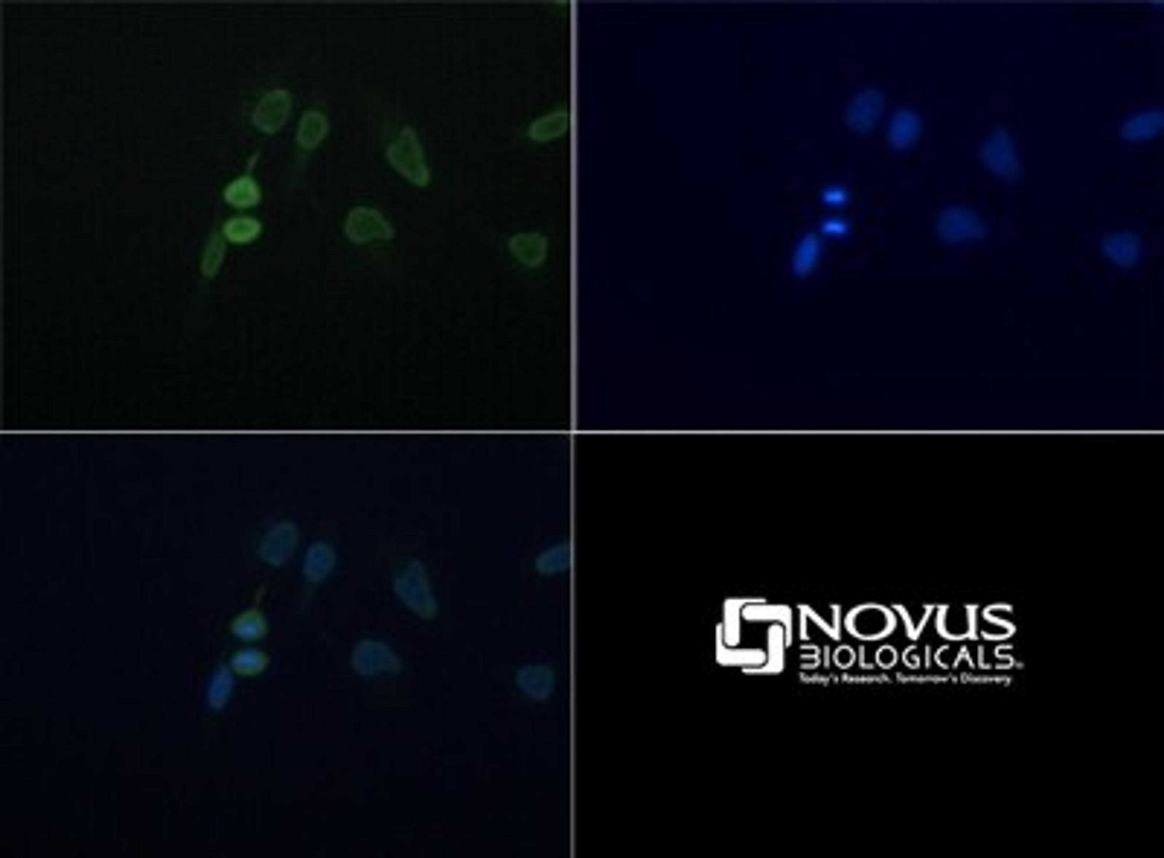 Immunocytochemistry/Immunofluorescence: FUS Antibody [NBP1-50623] - Staining of FUS in HeLa cells with  FITC (green). Nuclei were counterstained with DAPI (blue).