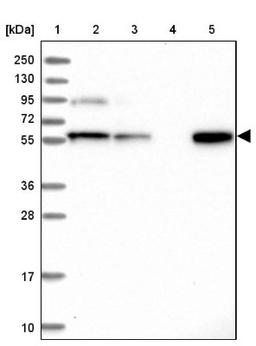 Western Blot: RSBN1 Antibody [NBP1-83765] - Lane 1: Marker [kDa] 250, 130, 95, 72, 55, 36, 28, 17, 10<br/>Lane 2: Human cell line RT-4<br/>Lane 3: Human cell line U-251MG sp<br/>Lane 4: Human plasma (IgG/HSA depleted)<br/>Lane 5: Human liver tissue