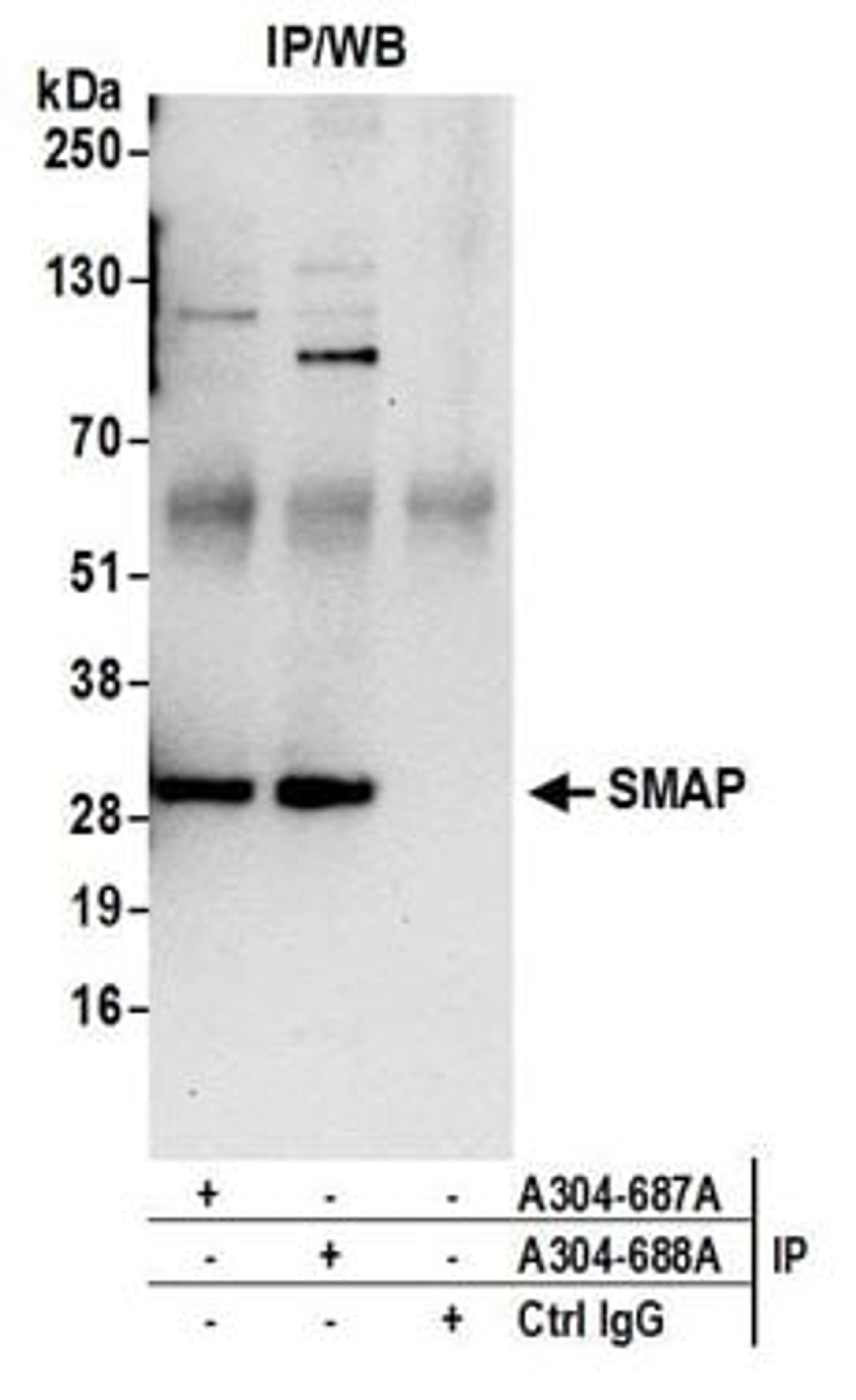 Detection of human SMAP by western blot of immunoprecipitates.