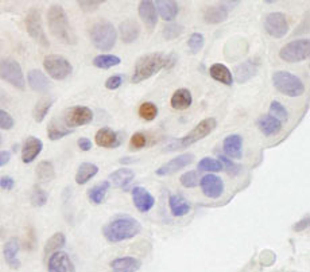 Detection of human MAML2 by immunohistochemistry.