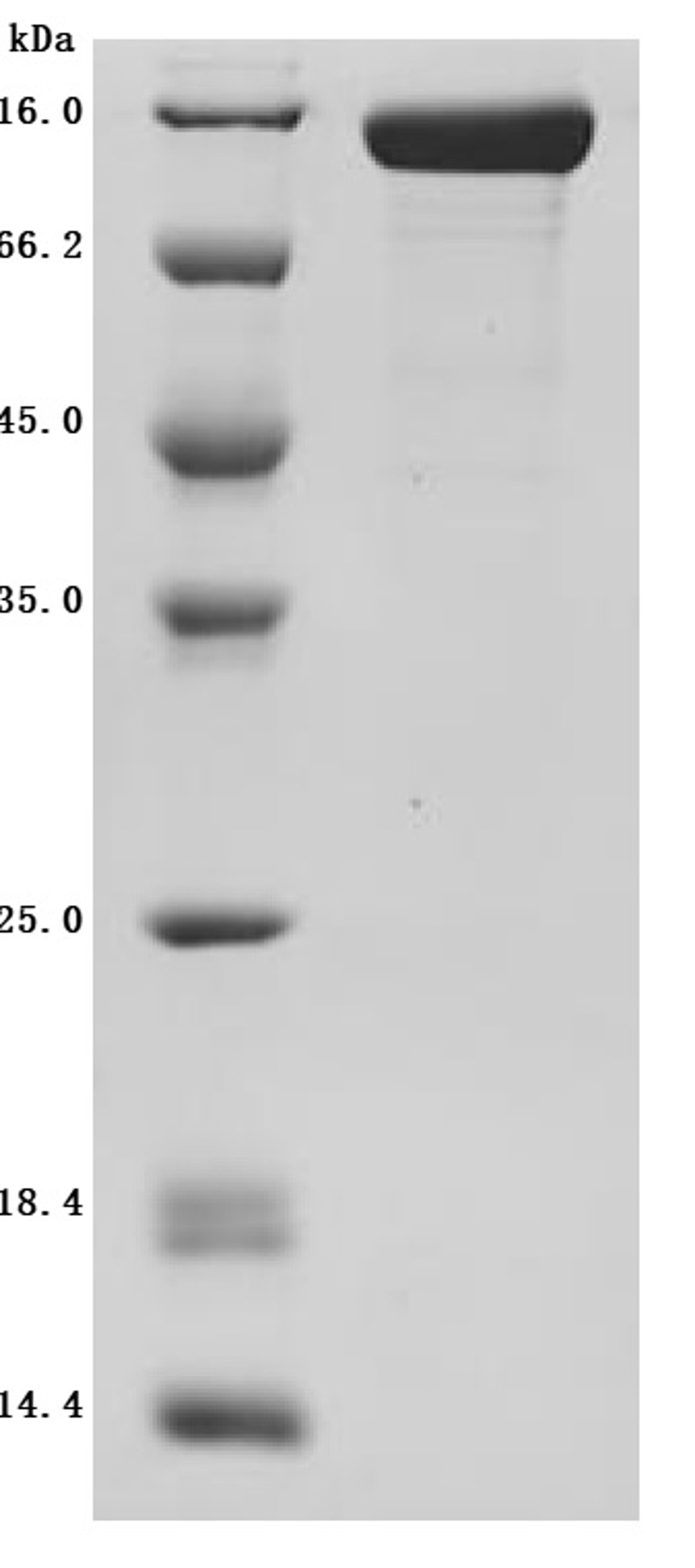 (Tris-Glycine gel) Discontinuous SDS-PAGE (reduced) with 5% enrichment gel and 15% separation gel.