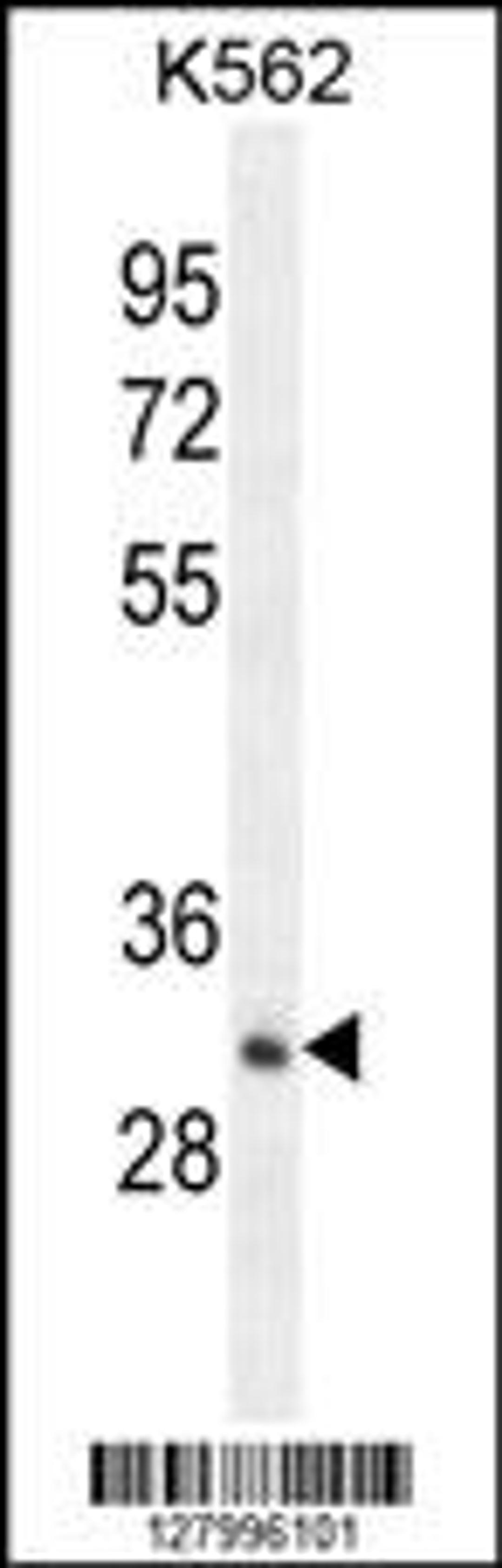 Western blot analysis in K562 cell line lysates (35ug/lane).