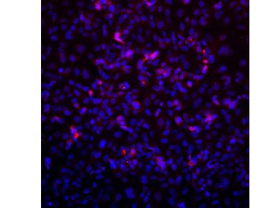 Immunocytochemistry/Immunofluorescence: VPS39 Antibody [NBP1-76535] - Saos2 Cells, anti-VPS39 primary, Hoescht33342, anti-Rabbit alexa594 secondary. Image from verified customer review.