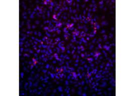 Immunocytochemistry/Immunofluorescence: VPS39 Antibody [NBP1-76535] - Saos2 Cells, anti-VPS39 primary, Hoescht33342, anti-Rabbit alexa594 secondary. Image from verified customer review.