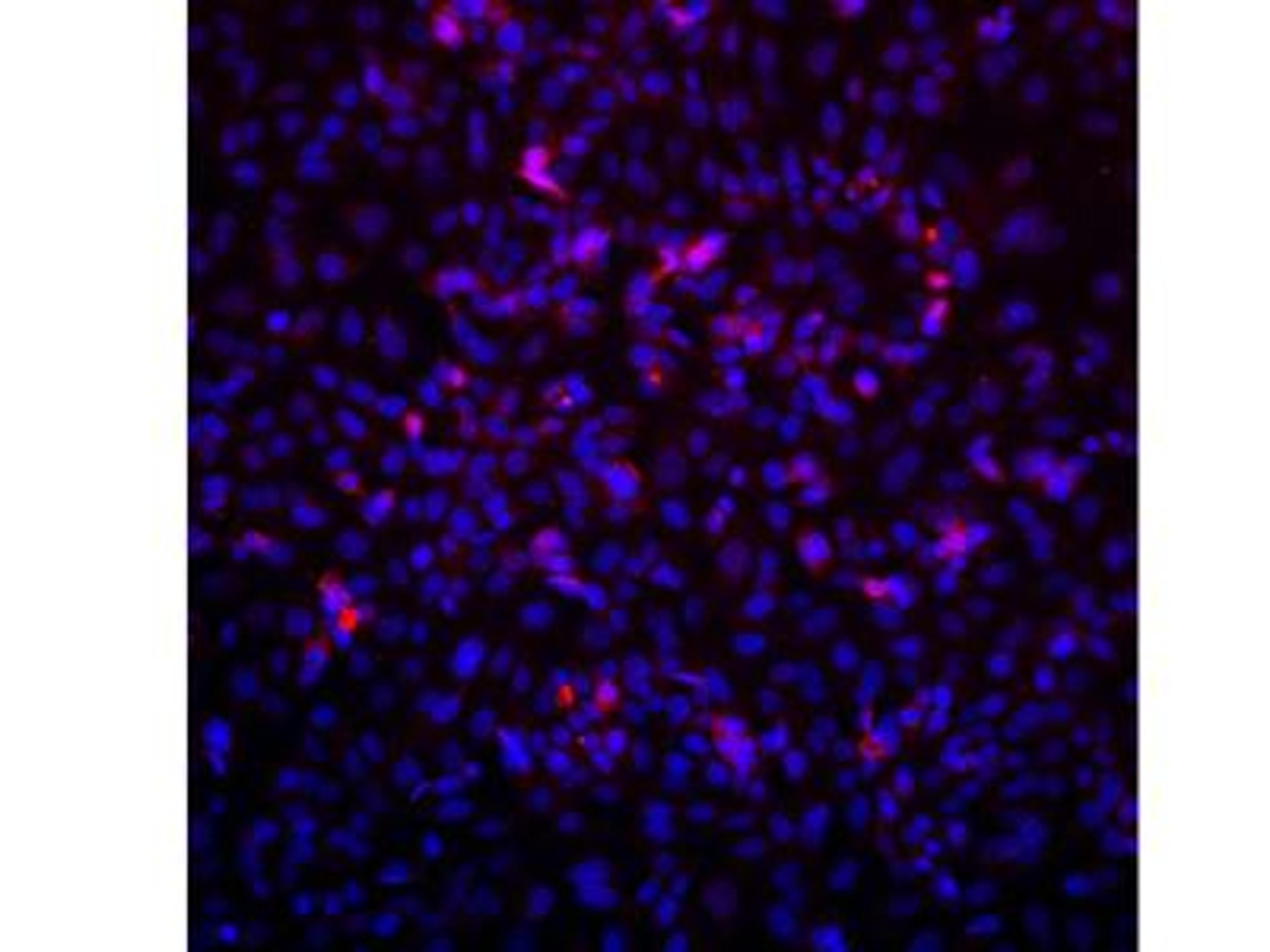 Immunocytochemistry/Immunofluorescence: VPS39 Antibody [NBP1-76535] - Saos2 Cells, anti-VPS39 primary, Hoescht33342, anti-Rabbit alexa594 secondary. Image from verified customer review.