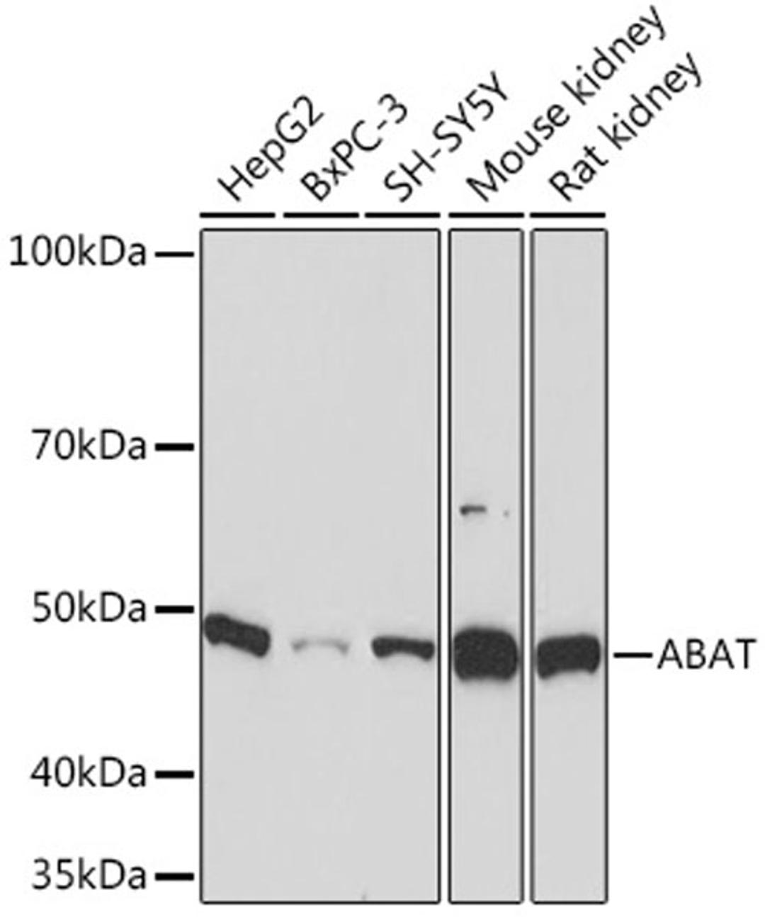 Western blot - ABAT Rabbit mAb (A9146)