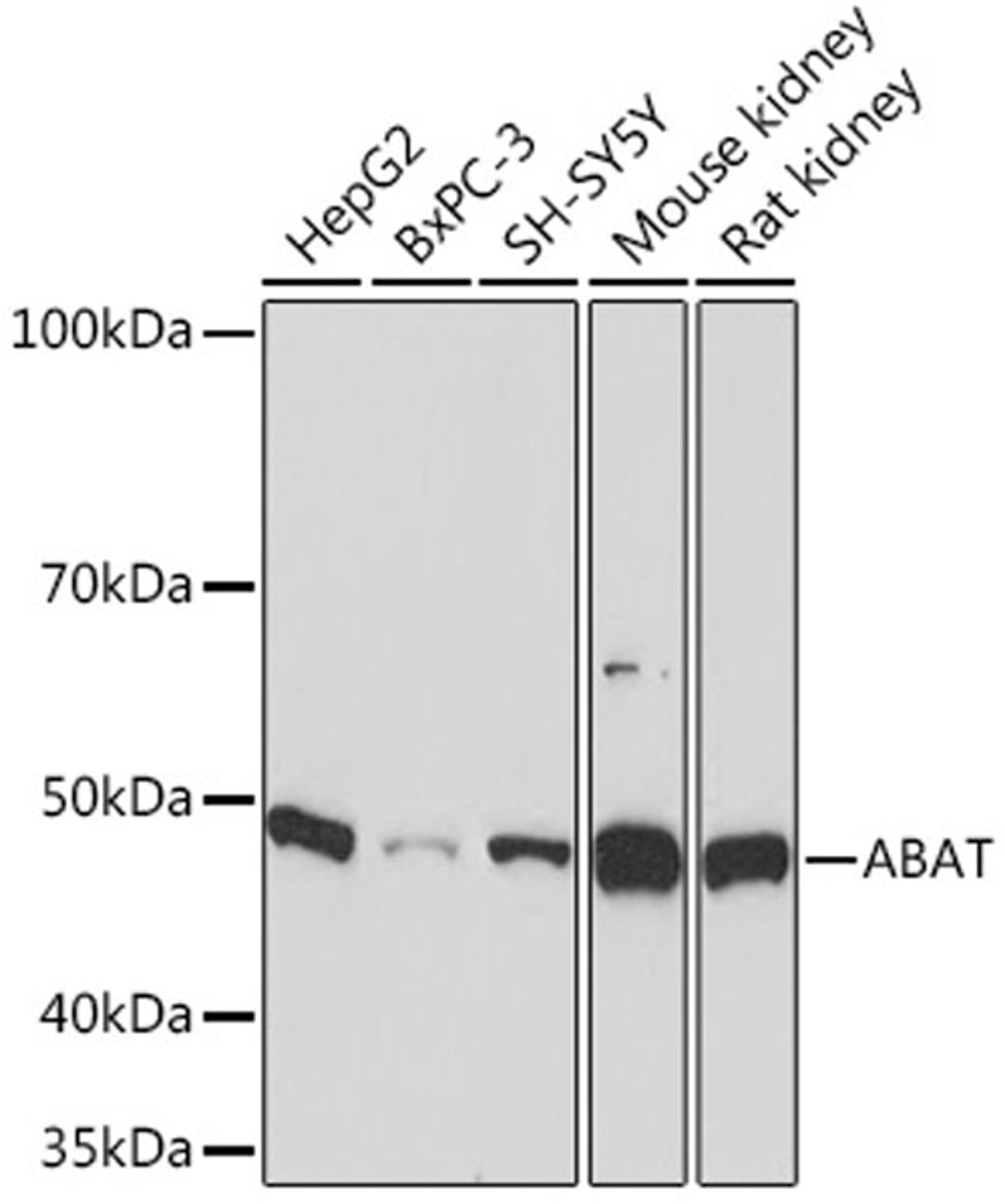 Western blot - ABAT Rabbit mAb (A9146)