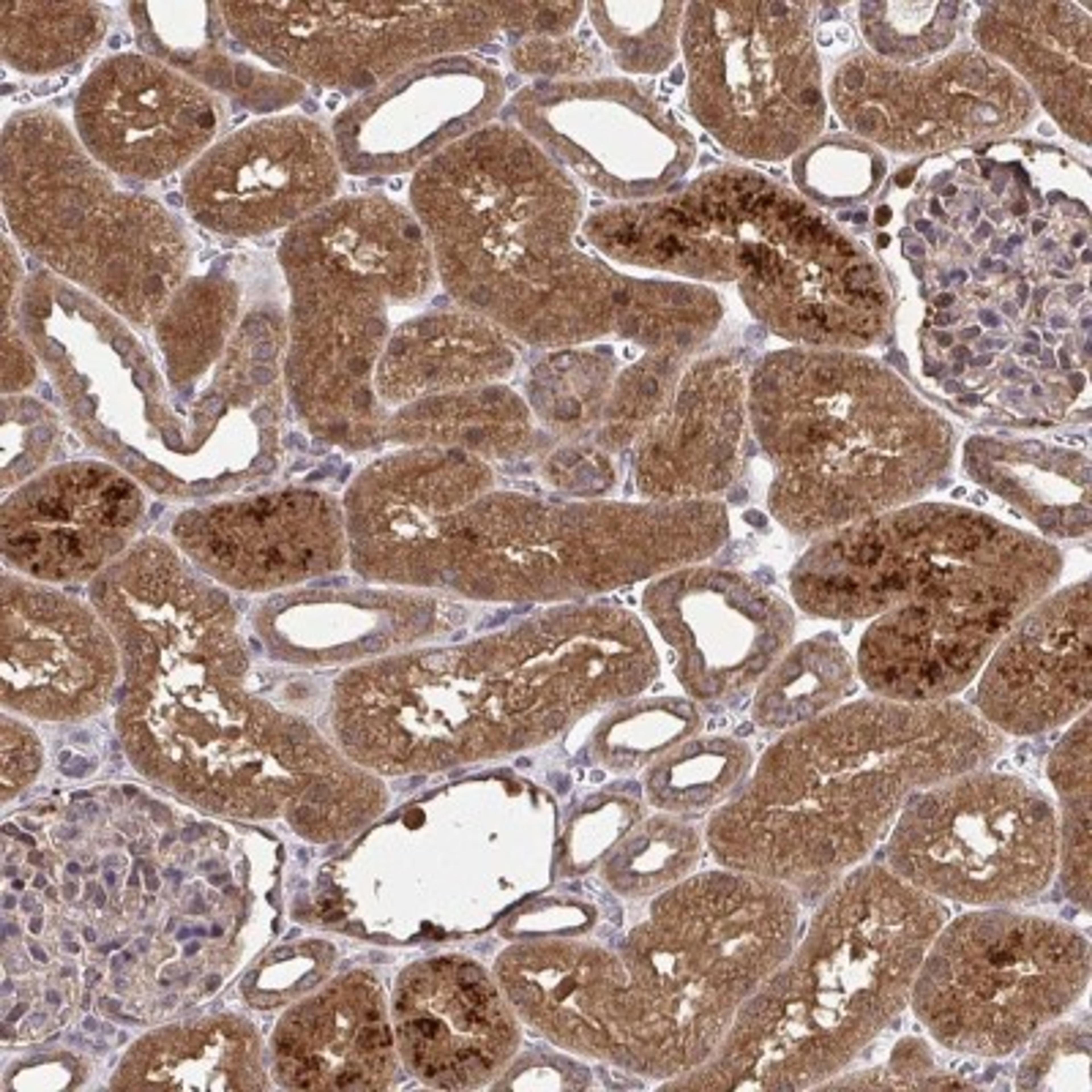 Immunohistochemistry: RDH14 Antibody [NBP2-31647] - Staining of human kidney shows strong cytoplasmic positivity in cells in tubules.