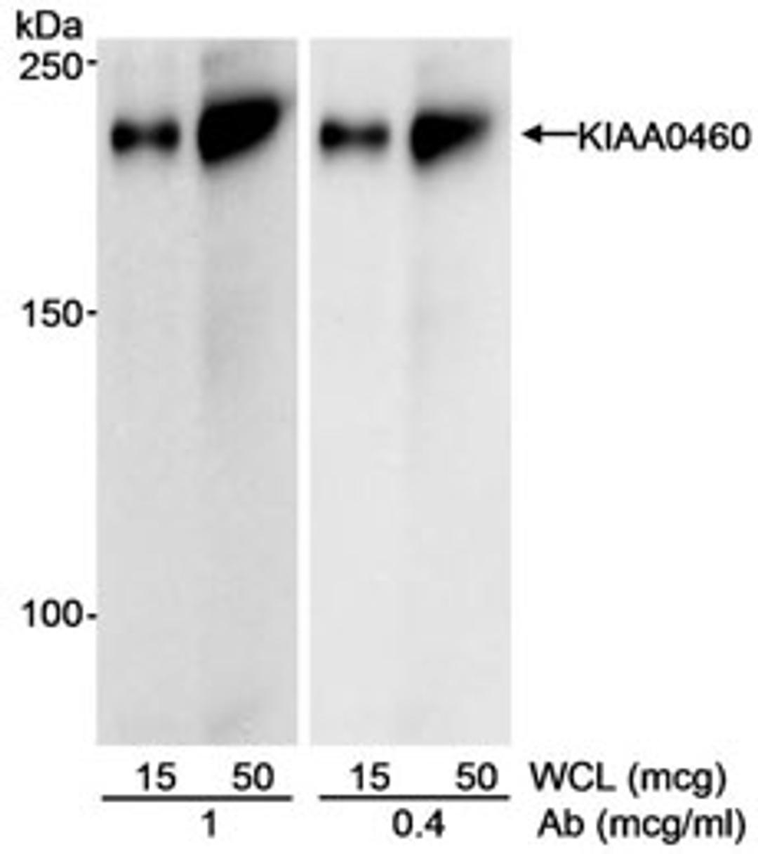 Detection of human KIAA0460 by western blot.