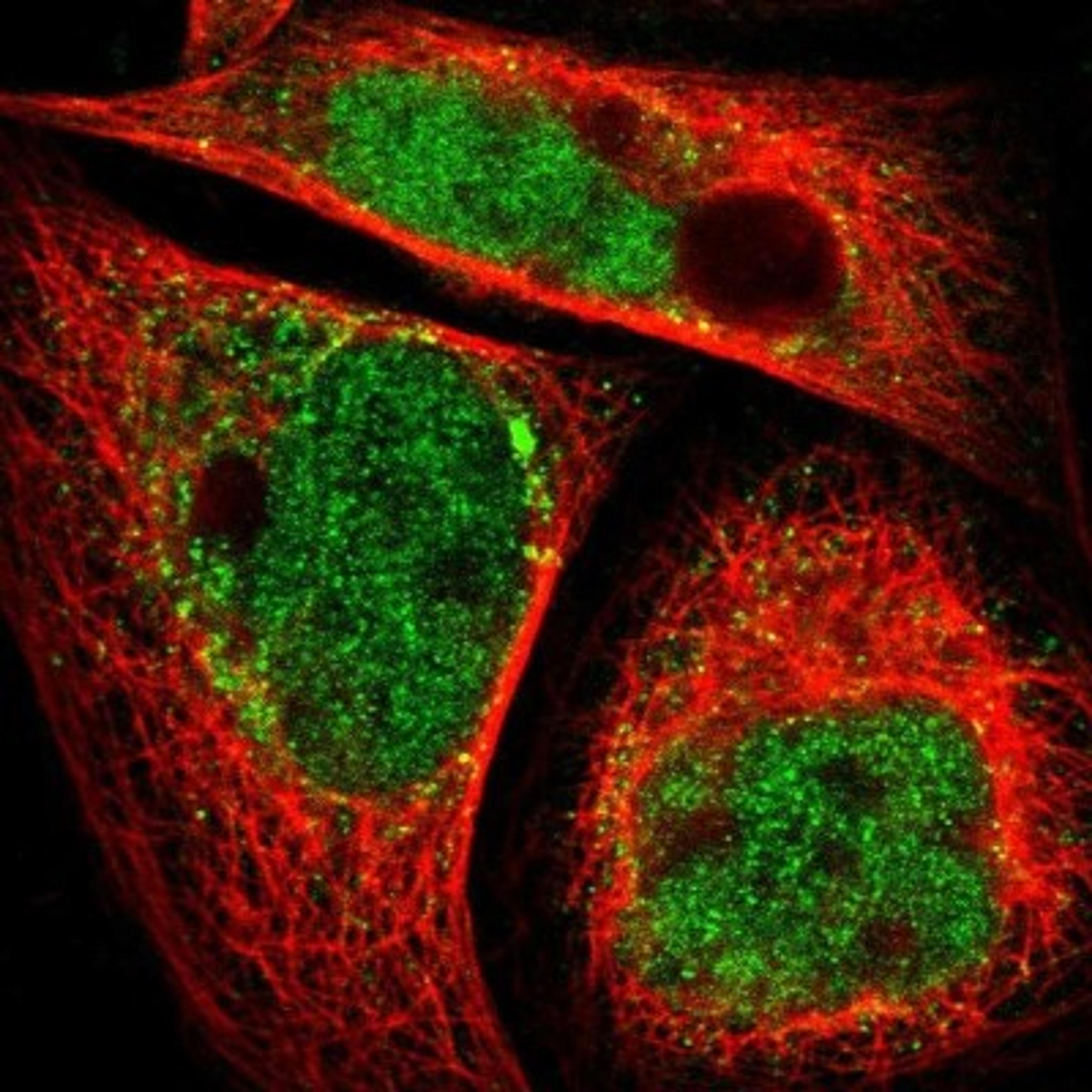 Immunofluorescence: ASB9 Antibody [NBP1-85082] - Immunofluorescent staining of human cell line A-431 shows positivity in nucleus but not nucleoli & cytoplasm.