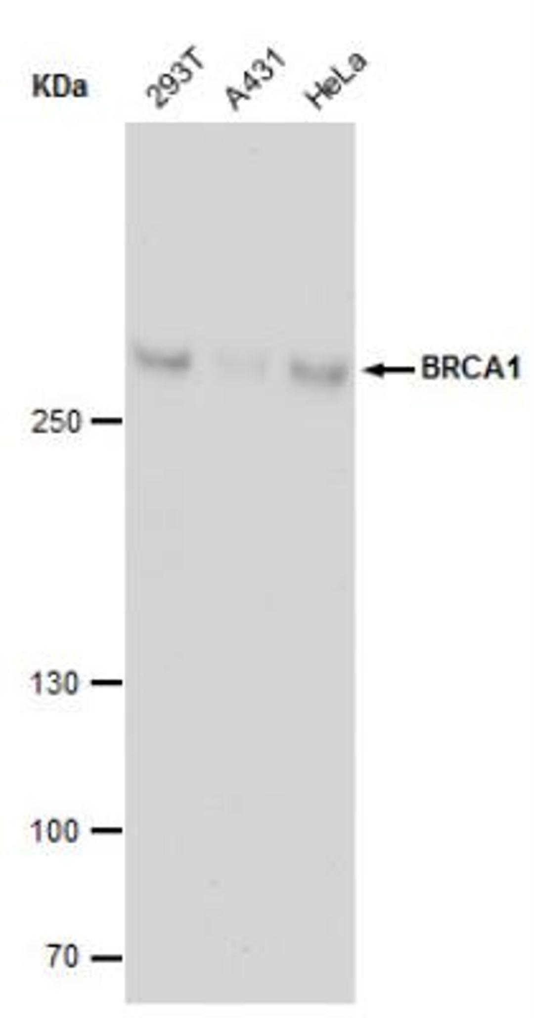 Chromatin Immunoprecipitation: BRCA1 Antibody (17F8) [NBP1-41185] - ChIP grade detects BRCA1 protein by western blot analysis. Various whole cell extracts (30 ug) were separated by 5 % SDS-PAGE, and blotted with BRCA1 antibody [17F8] - ChIP grade BRCA1 diluted by 1:500