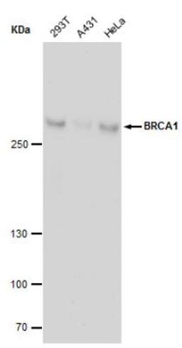 Chromatin Immunoprecipitation: BRCA1 Antibody (17F8) [NBP1-41185] - ChIP grade detects BRCA1 protein by western blot analysis. Various whole cell extracts (30 ug) were separated by 5 % SDS-PAGE, and blotted with BRCA1 antibody [17F8] - ChIP grade BRCA1 diluted by 1:500