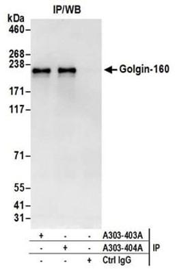 Detection of human Golgin-160 by western blot of immunoprecipitates.