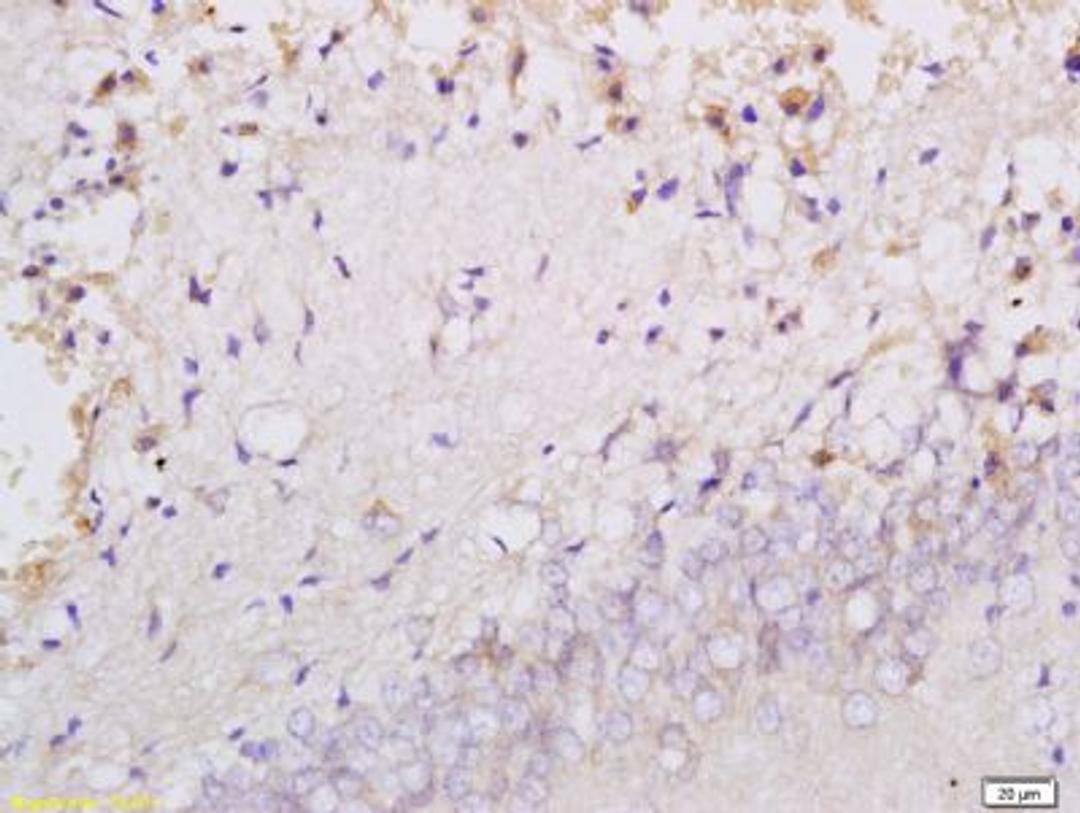 Immunohistochemical staining of rat brain tissue using CLEC2 antibody.