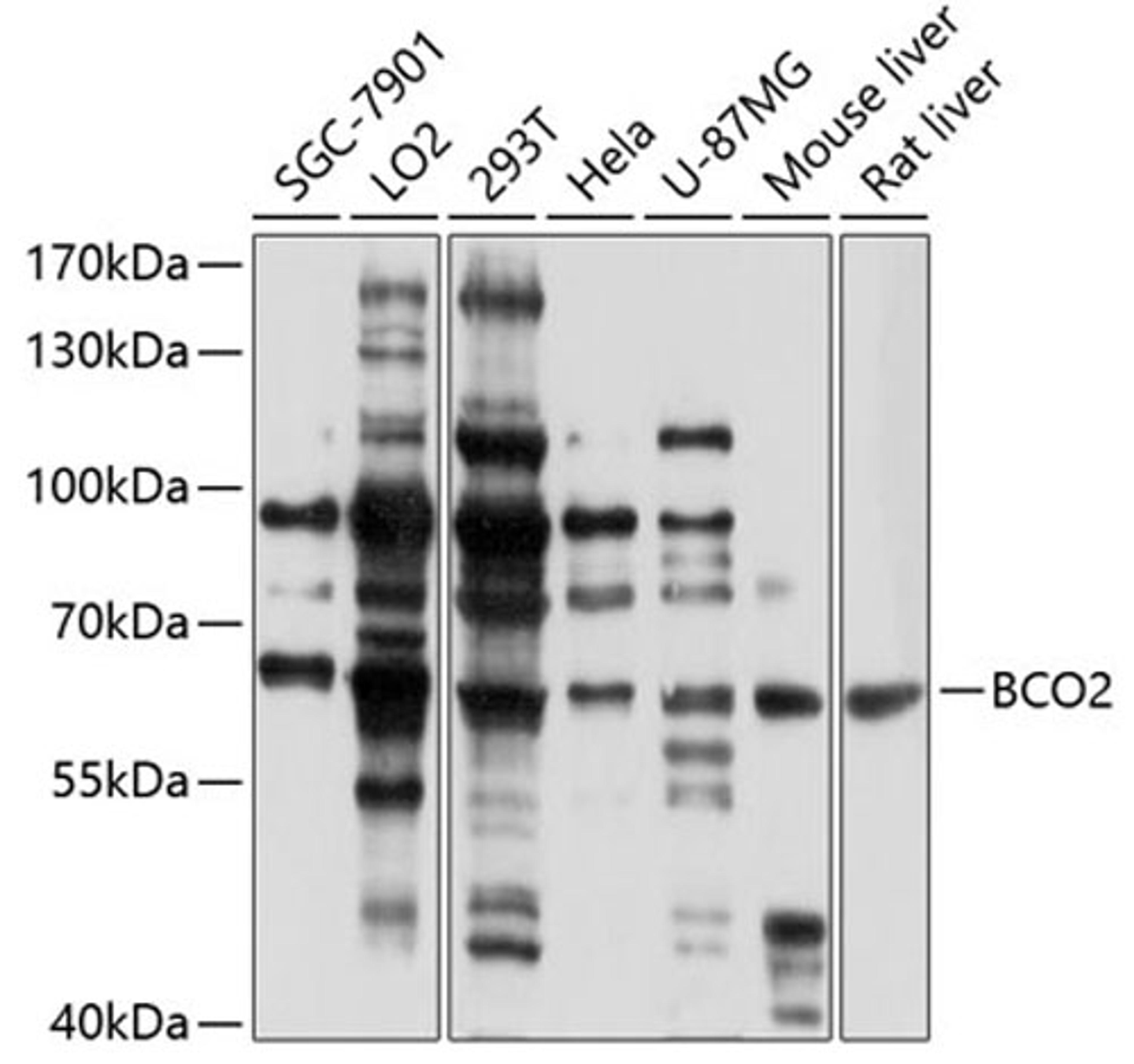 Western blot - BCO2 antibody (A5034)