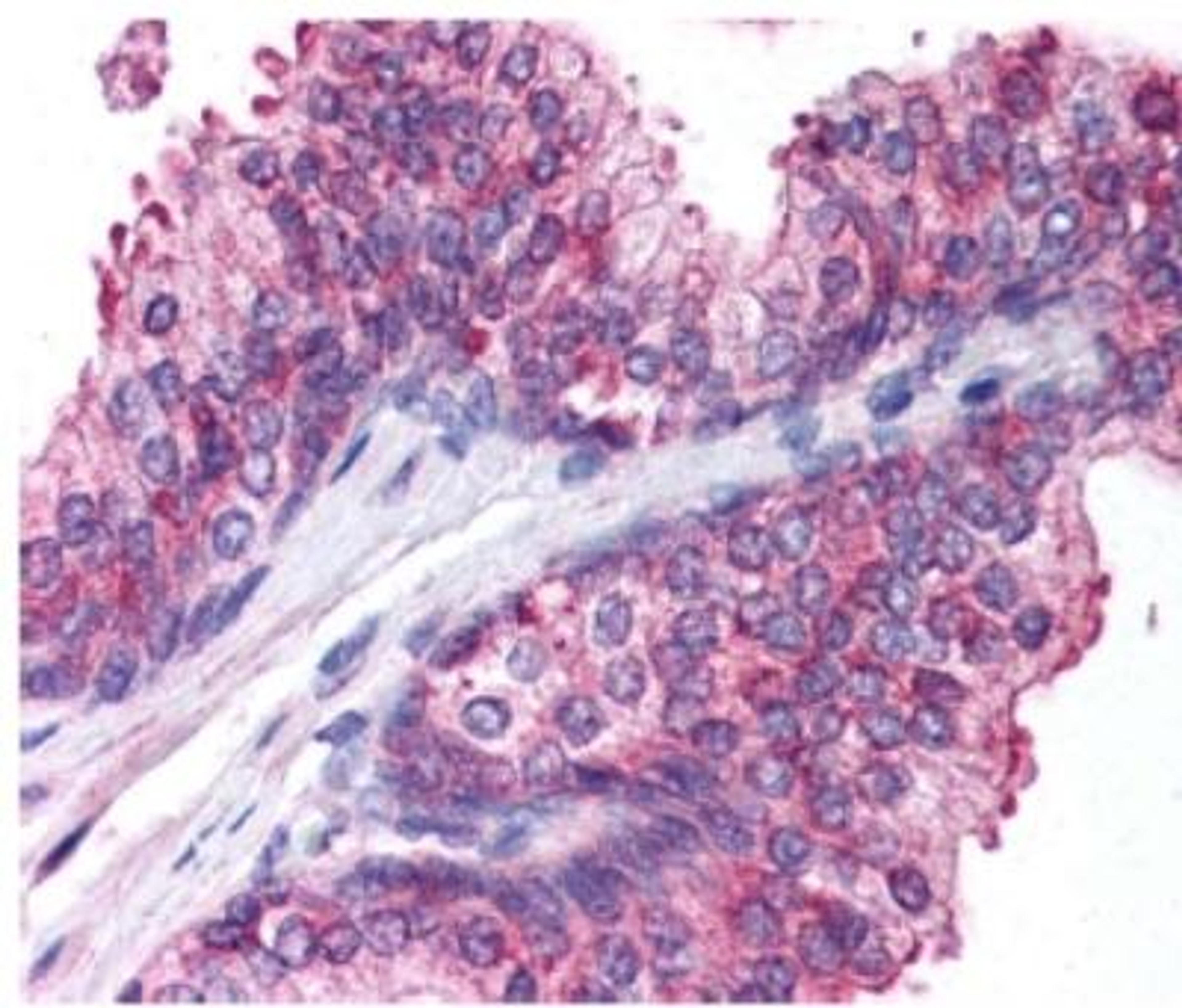 Immunohistochemistry-Paraffin: Spectrin beta 3 Antibody [NB110-58346] - Detection of Spectrin beta 3 in human prostate epithelium.