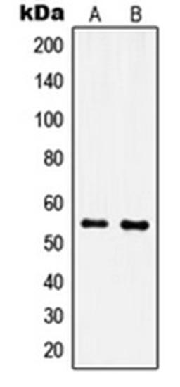 Western blot analysis of MCF7 (Lane 1), NIH3T3 (Lane 2) whole cell lysates using IPPK antibody