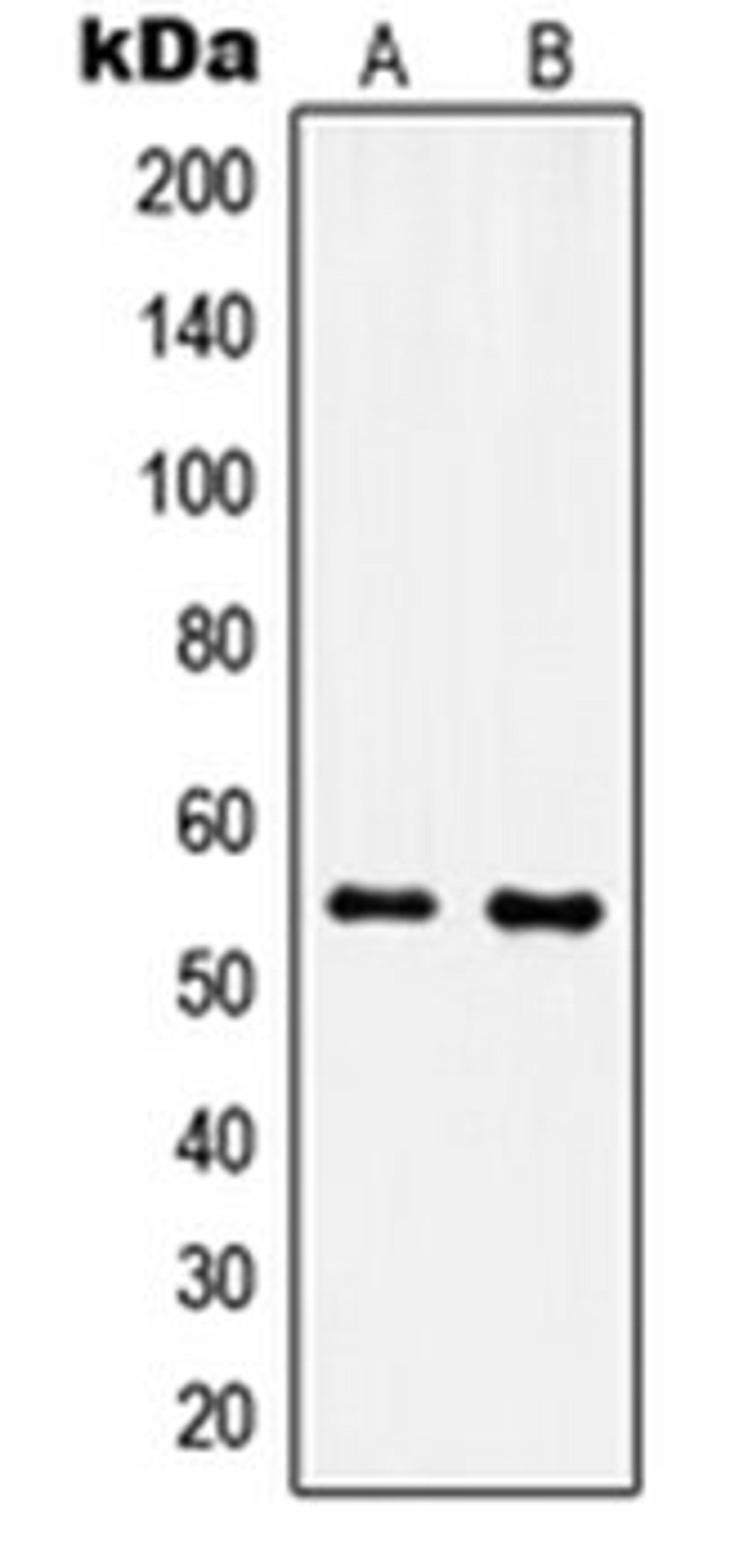 Western blot analysis of MCF7 (Lane 1), NIH3T3 (Lane 2) whole cell lysates using IPPK antibody