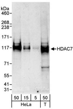 Detection of human HDAC7 by western blot.