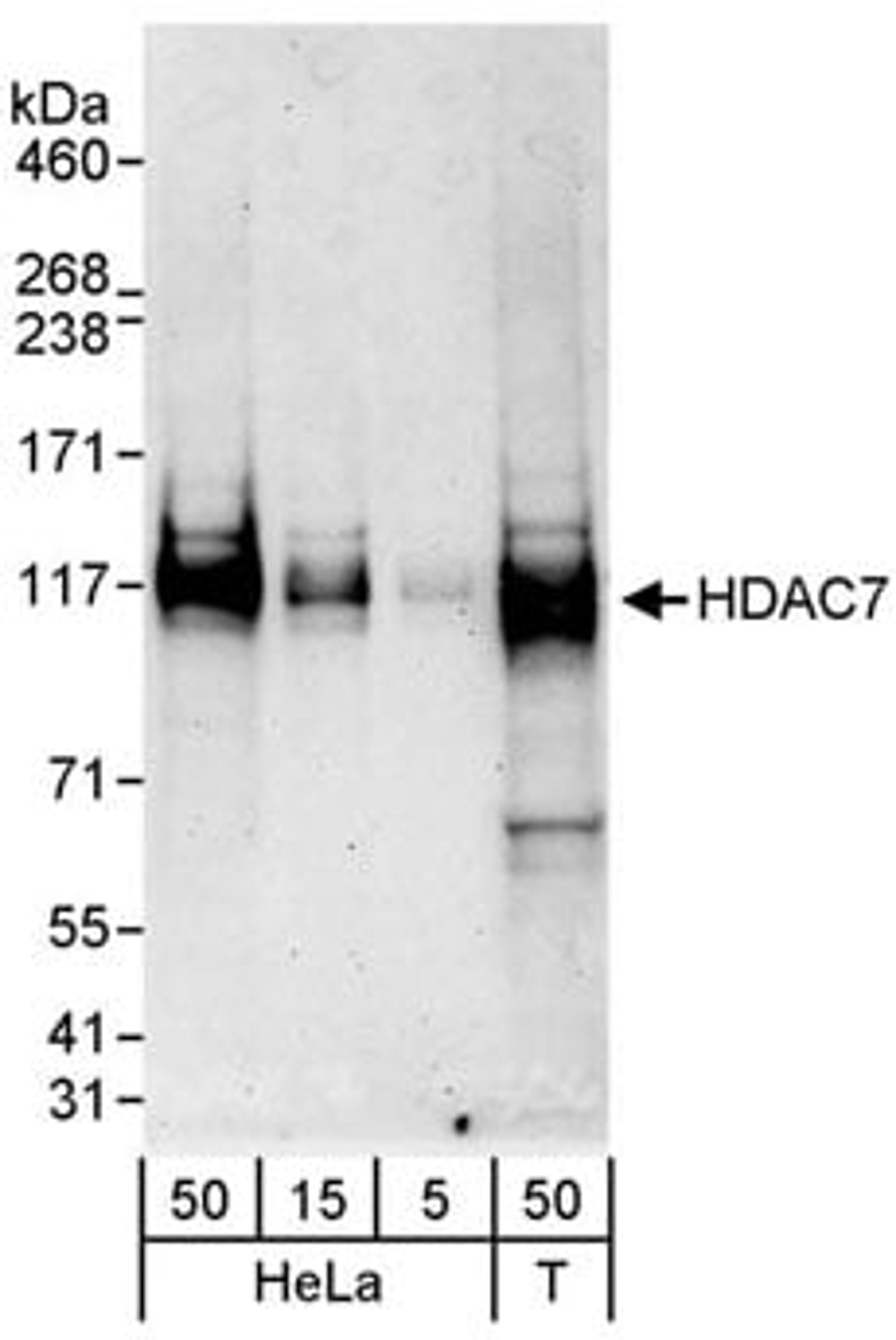 Detection of human HDAC7 by western blot.