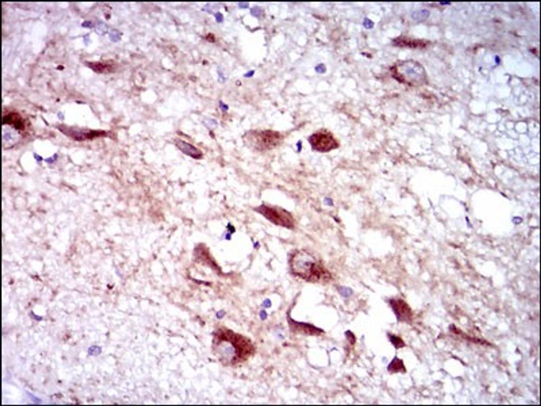 Immunohistochemistry: Cytochrome P450 3A4 Antibody (3H8) [NBP2-37502] - Immunohistochemical analysis of paraffin-embedded human brain tissues using CYP3A4 mouse mAb with DAB staining.