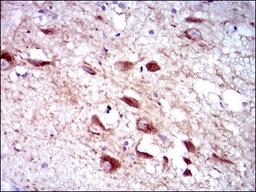 Immunohistochemistry: Cytochrome P450 3A4 Antibody (3H8) [NBP2-37502] - Immunohistochemical analysis of paraffin-embedded human brain tissues using CYP3A4 mouse mAb with DAB staining.