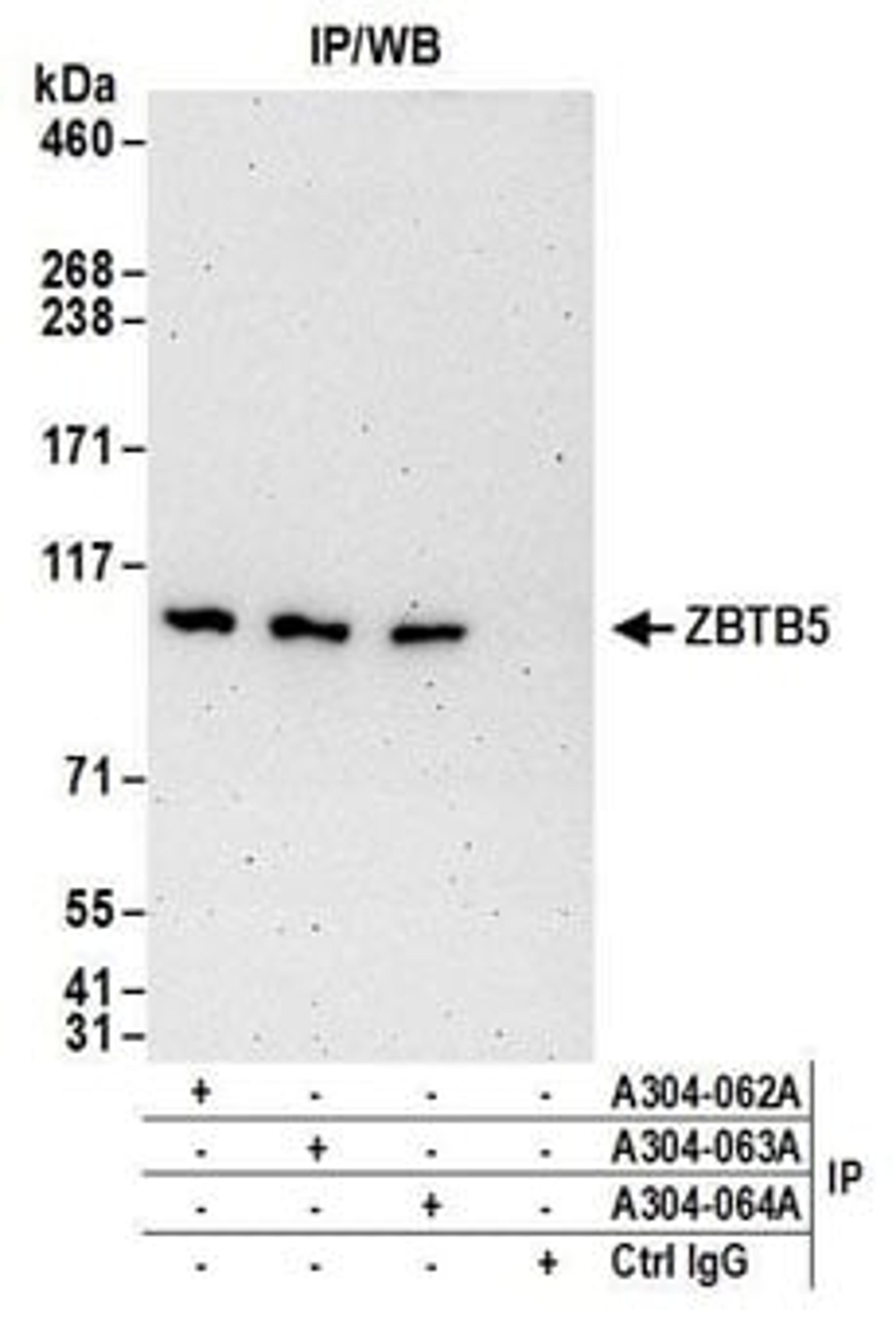 Detection of human ZBTB5 by western blot of immunoprecipitates.