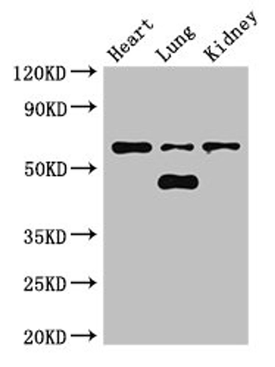 Western Blot. Positive WB detected in: Mouse heart tissue, Mouse lung tissue, Mouse kidney tissue. All lanes: CERK antibody at 3ug/ml. Secondary. Goat polyclonal to rabbit IgG at 1/50000 dilution. Predicted band size: 60, 38 kDa<br/>Observed band size: 60, 48 kDa<br/>